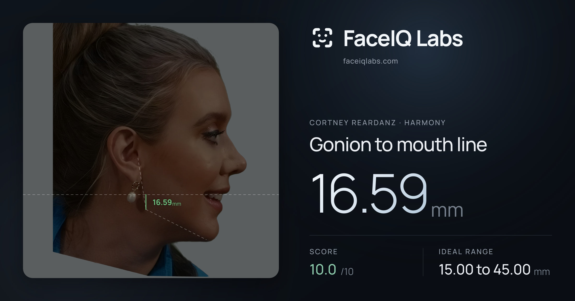 Cortney Reardanz Gonion to mouth line: 16.59mm, drawn on the photo