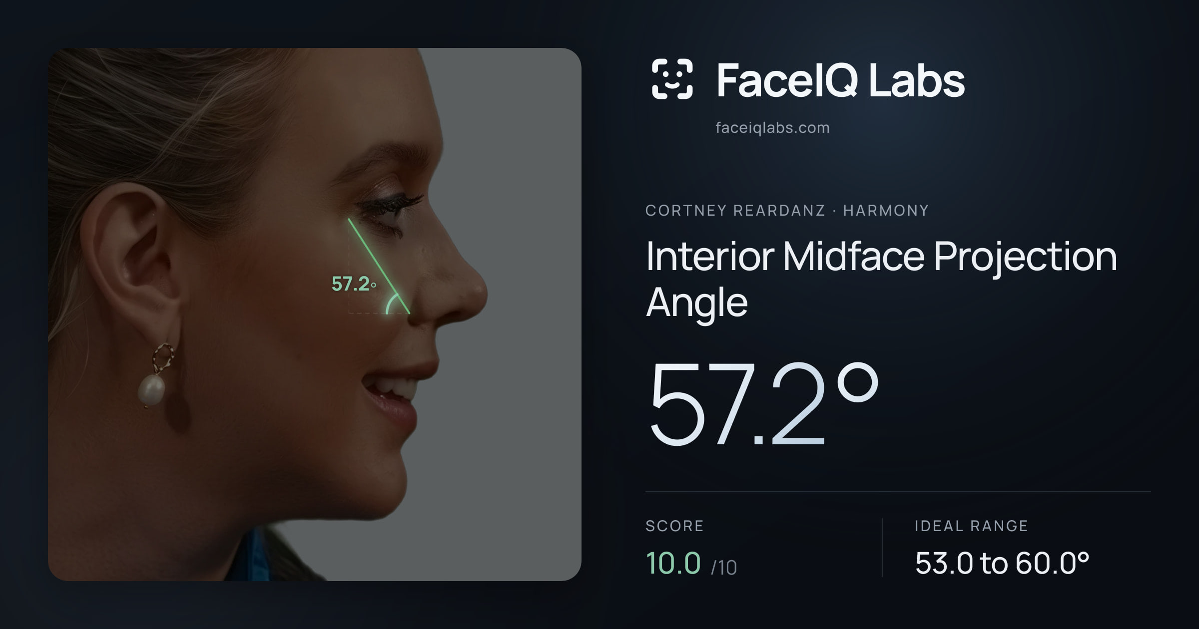 Cortney Reardanz Interior Midface Projection Angle: 57.2°, drawn on the photo