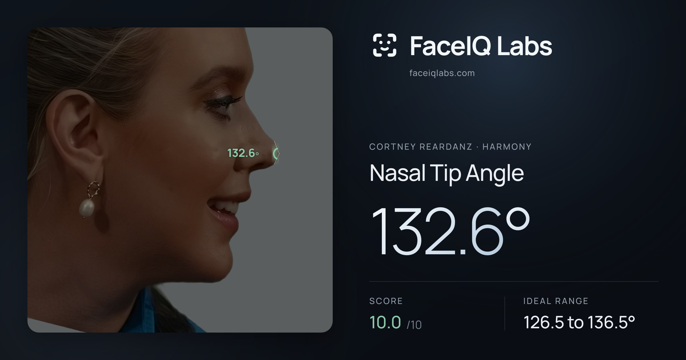 Cortney Reardanz Nasal Tip Angle: 132.6°, drawn on the photo