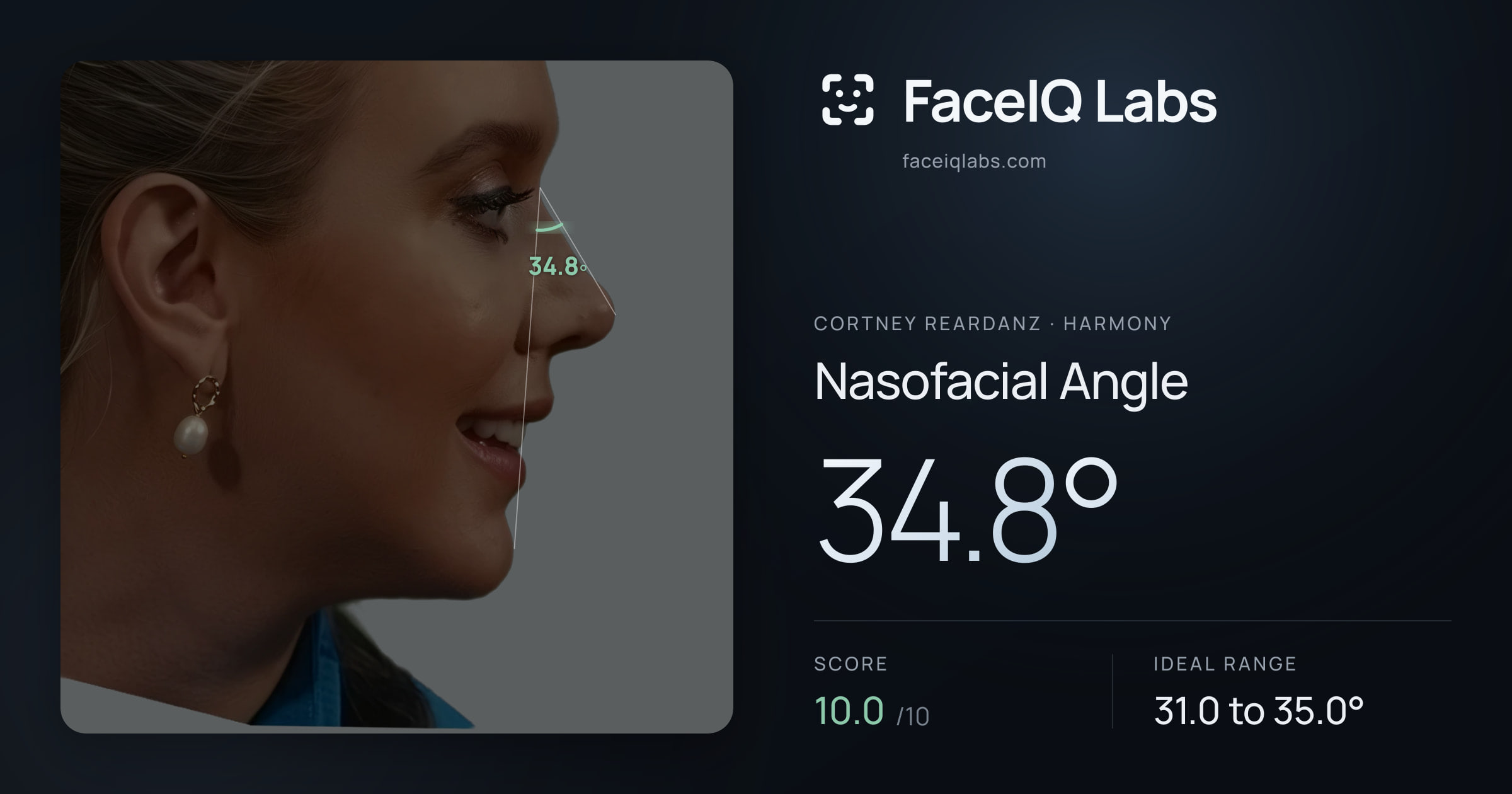 Cortney Reardanz Nasofacial Angle: 34.8°, drawn on the photo