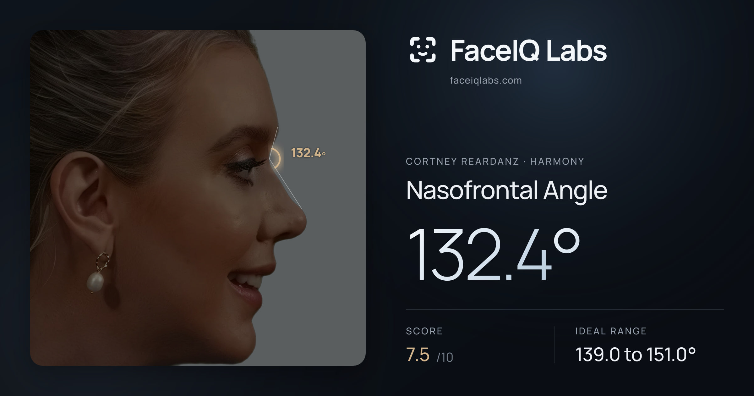 Cortney Reardanz Nasofrontal Angle: 132.4°, drawn on the photo