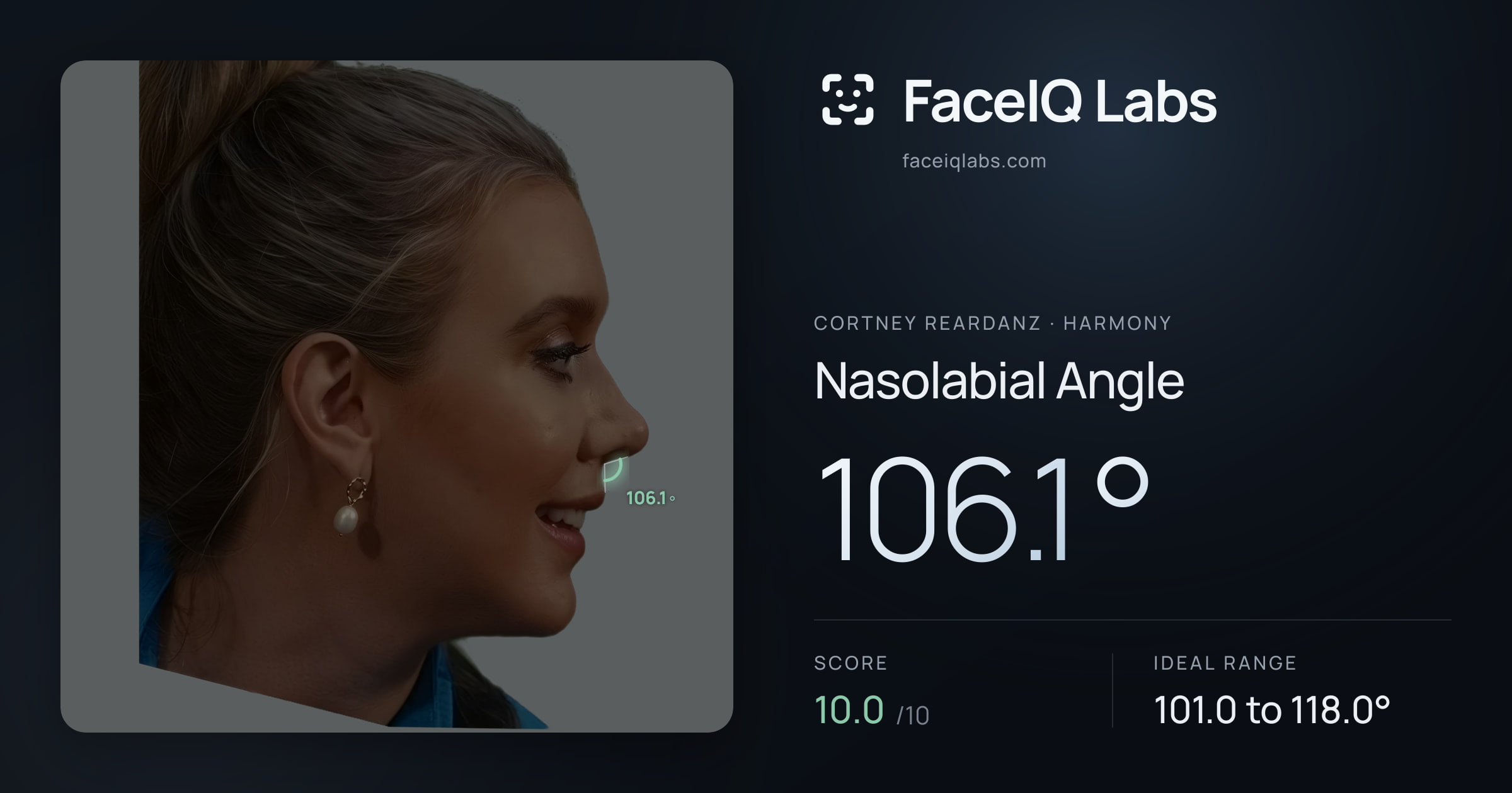 Cortney Reardanz Nasolabial Angle: 106.1°, drawn on the photo