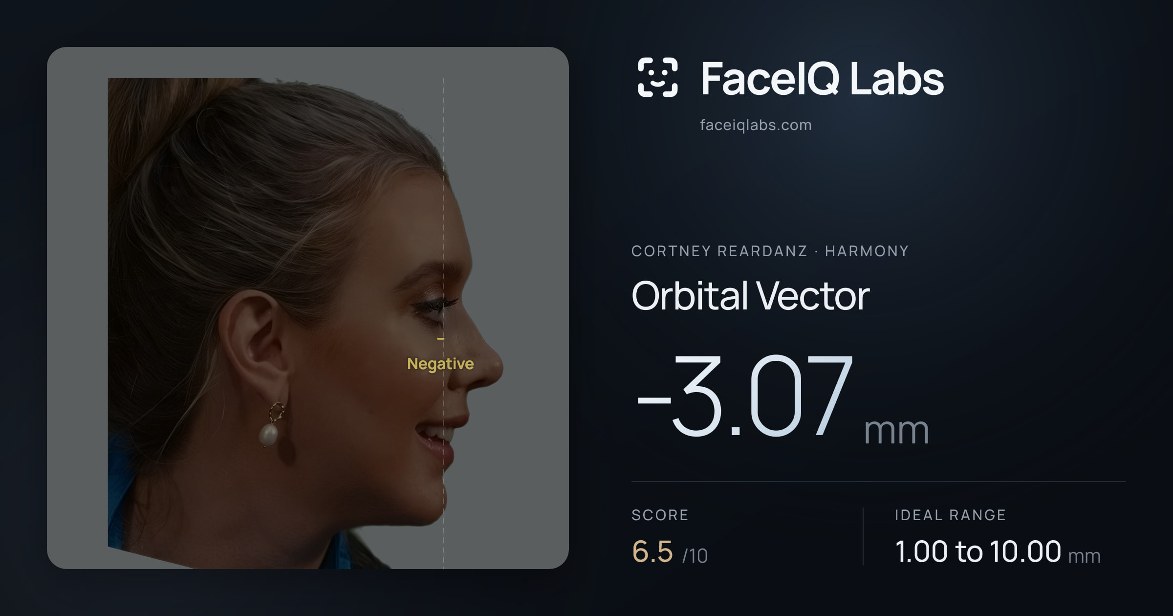 Cortney Reardanz Orbital Vector: -3.07mm, drawn on the photo