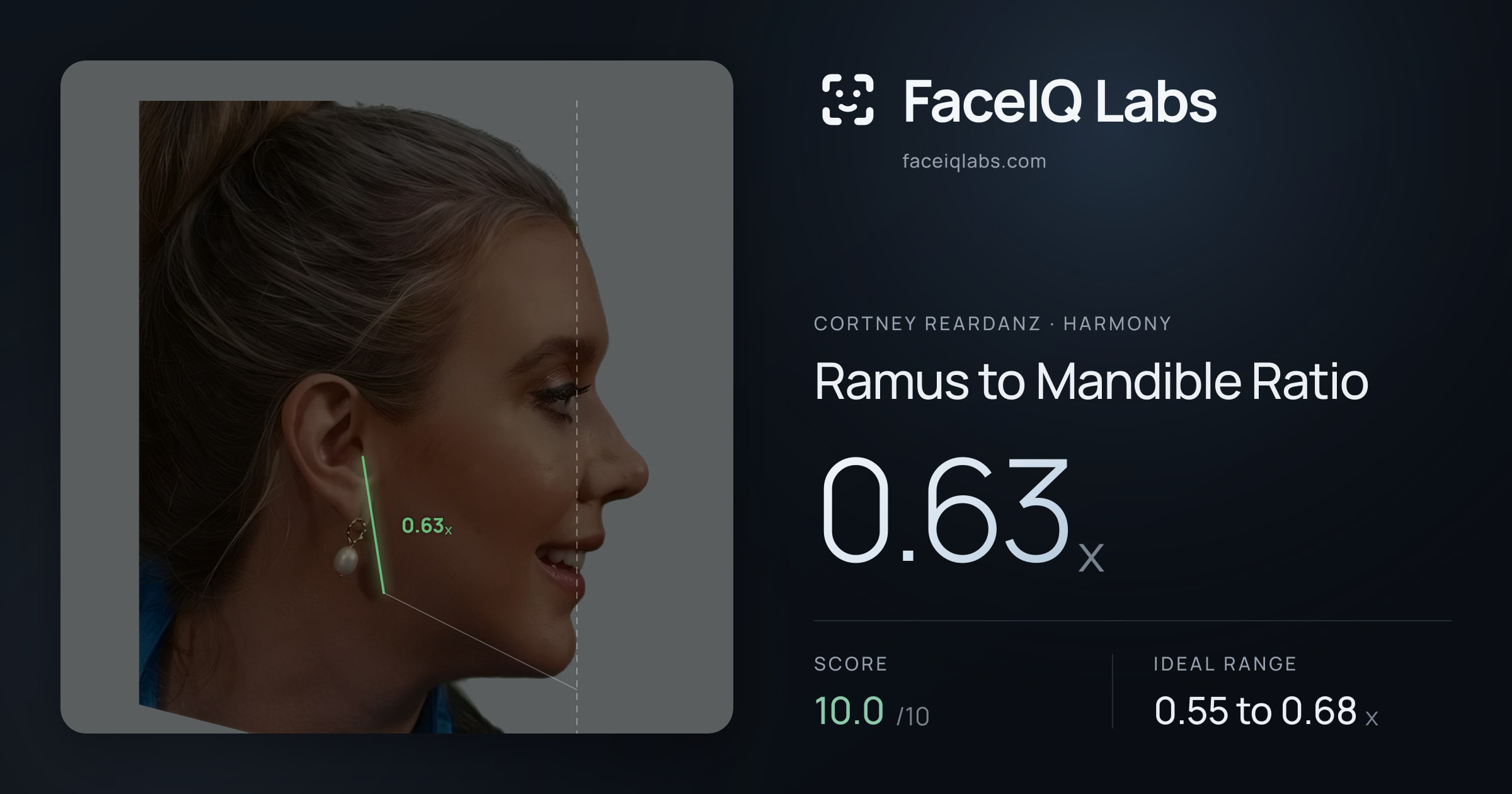 Cortney Reardanz Ramus to Mandible Ratio: 0.63x, drawn on the photo