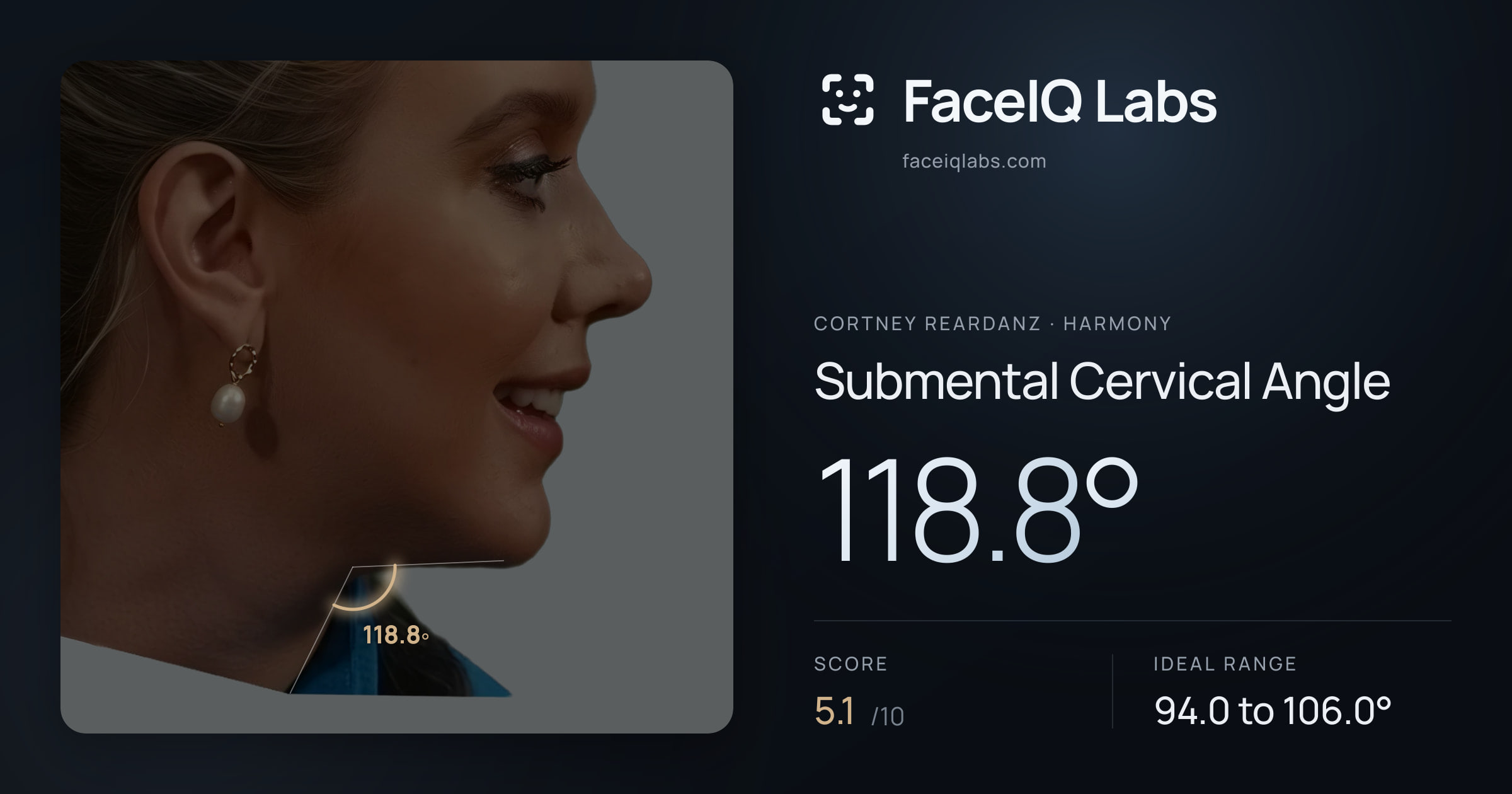 Cortney Reardanz Submental Cervical Angle: 118.8°, drawn on the photo