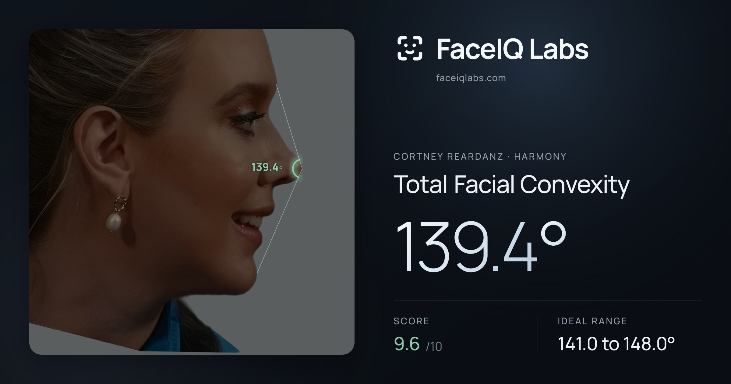 Cortney Reardanz Total Facial Convexity: 139.4°, drawn on the photo