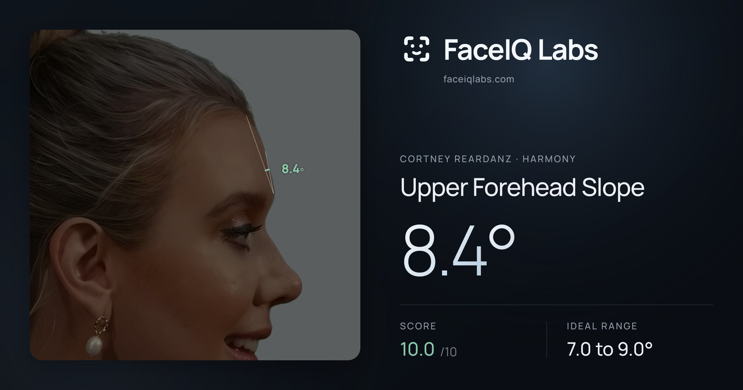Cortney Reardanz Upper Forehead Slope: 8.4°, drawn on the photo