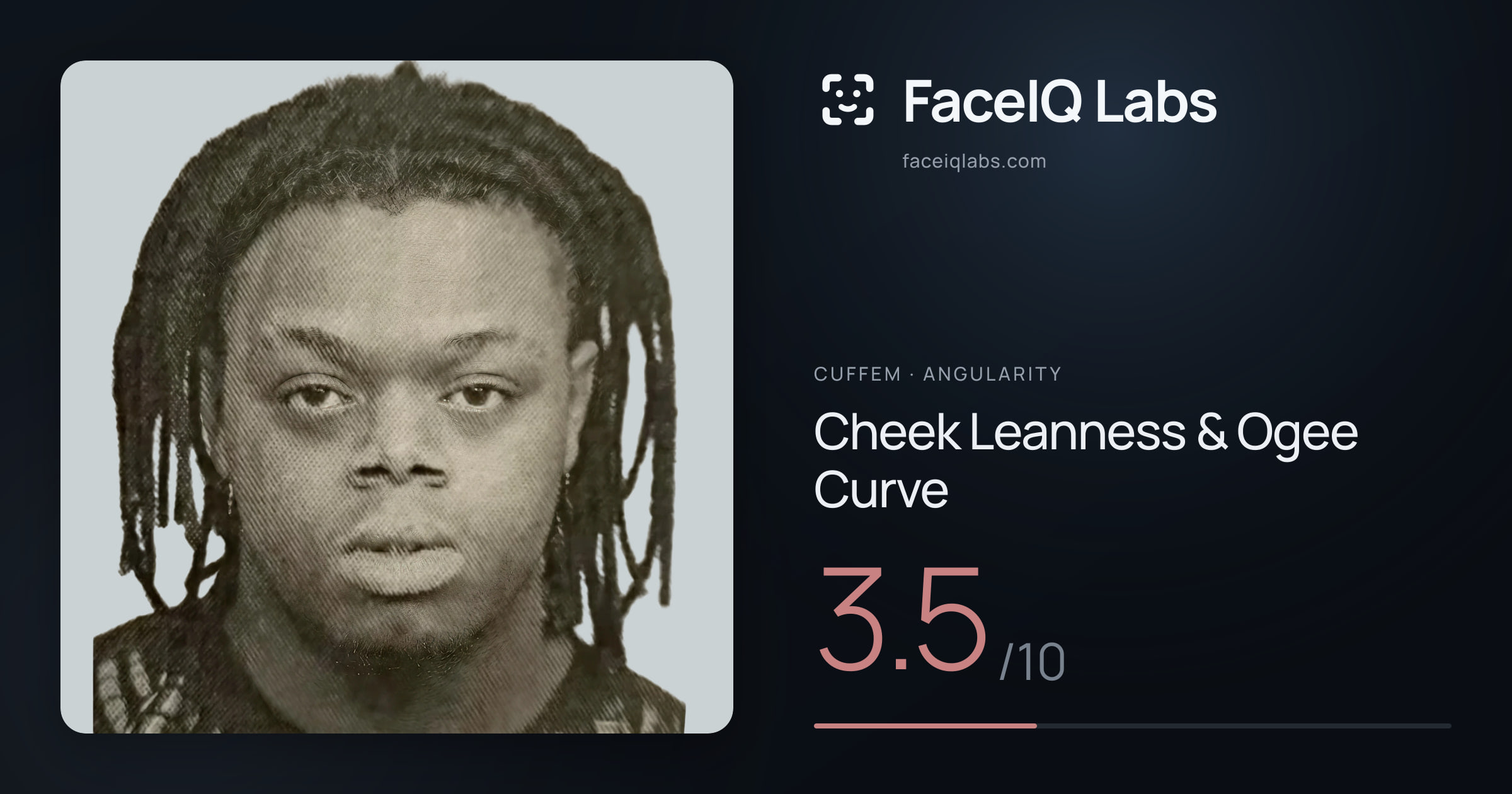 Cuffem Cheek Leanness & Ogee Curve: 3.5/10, drawn on the photo