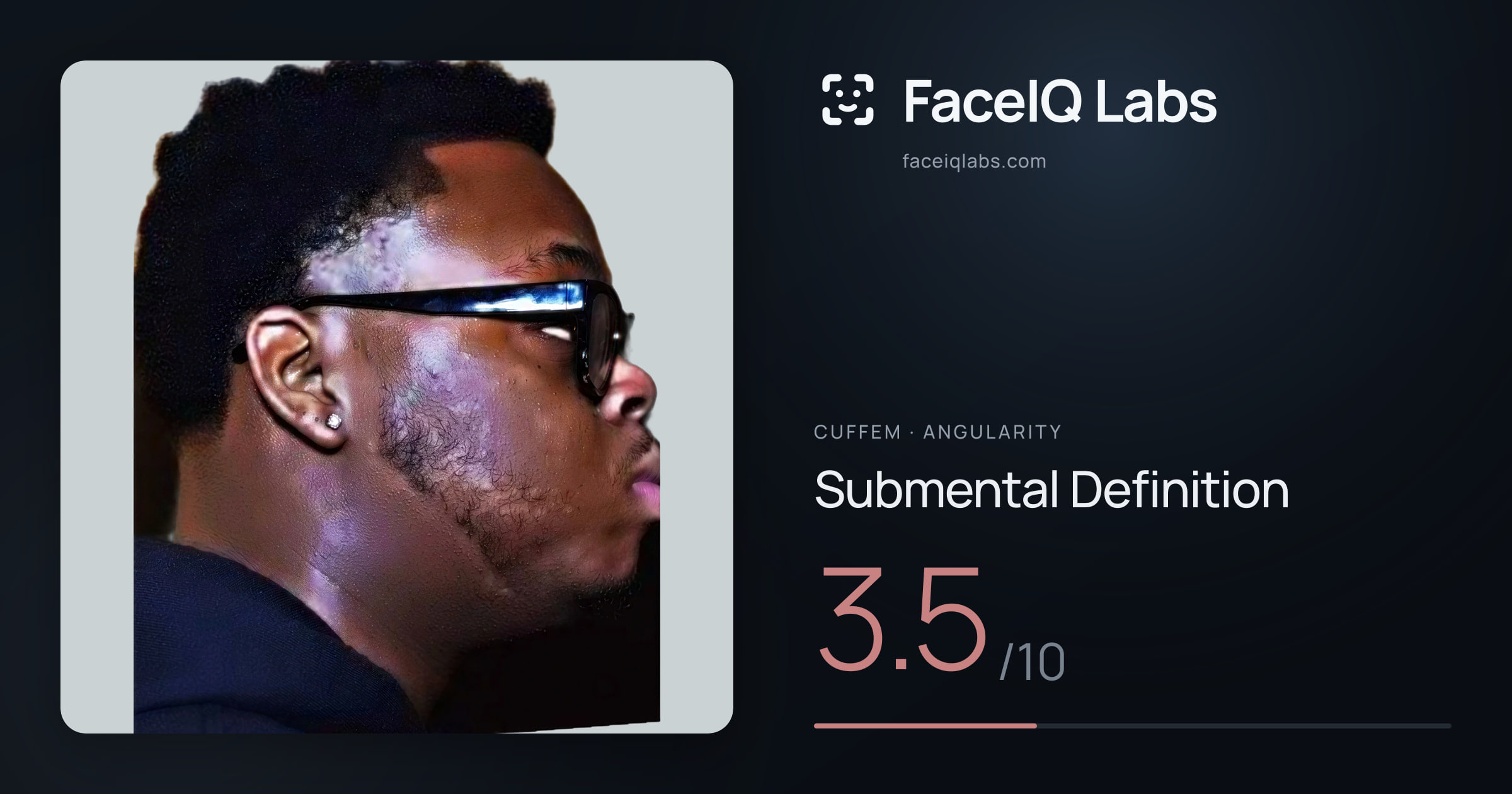 Cuffem Submental Definition: 3.5/10, drawn on the photo