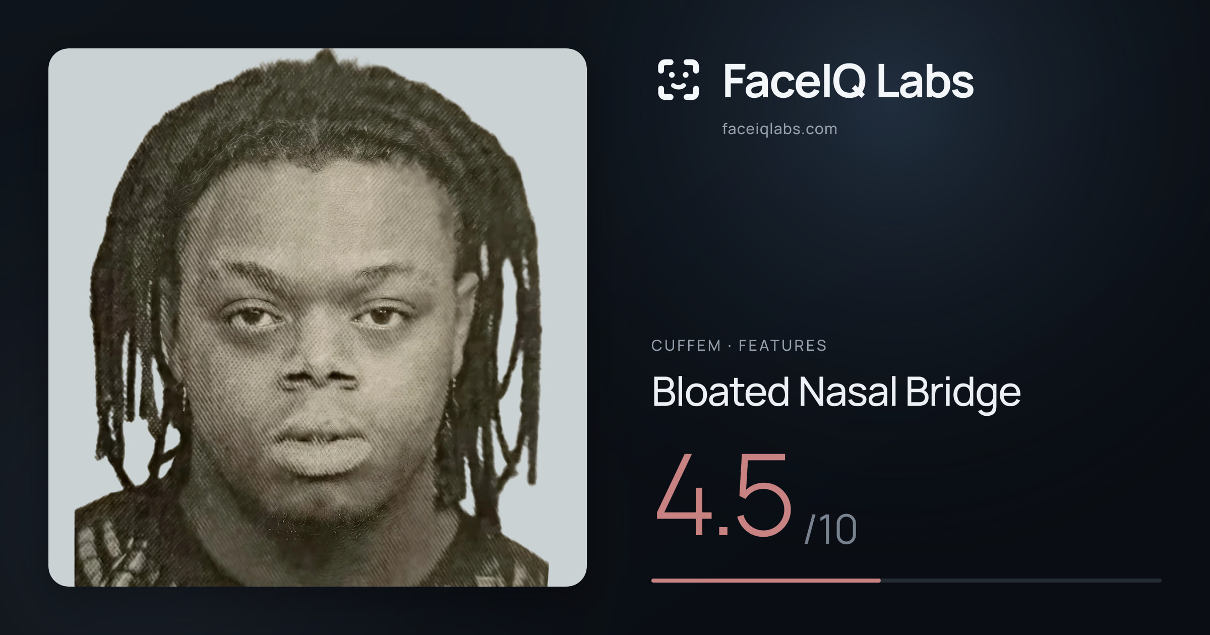 Cuffem Bloated Nasal Bridge: 4.5/10, drawn on the photo