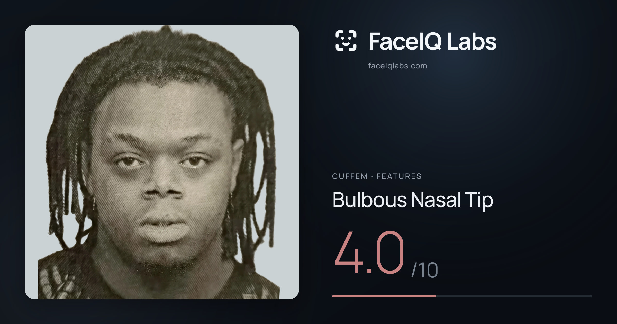 Cuffem Bulbous Nasal Tip: 4.0/10, drawn on the photo