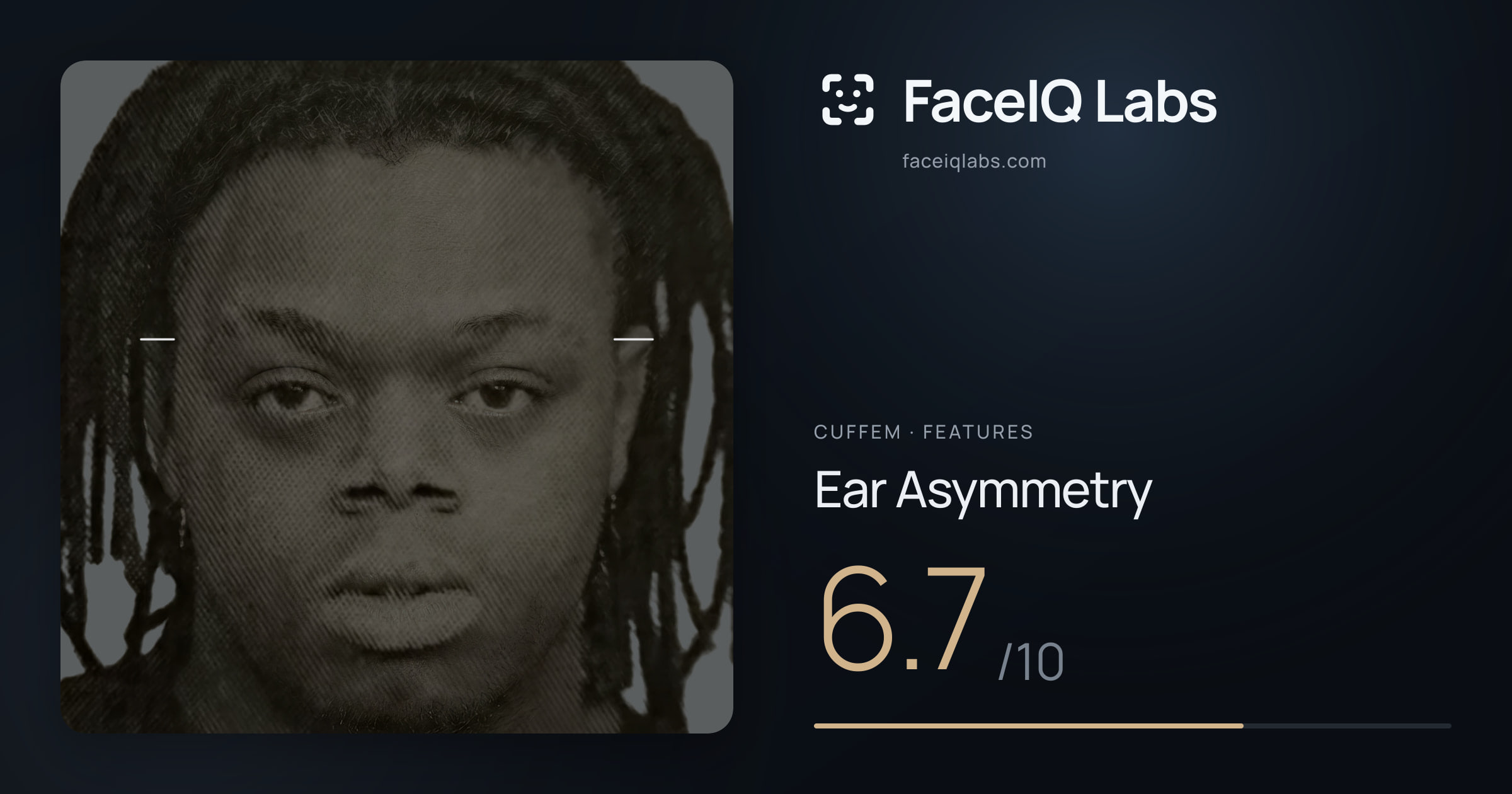 Cuffem Ear Asymmetry: 6.7/10, drawn on the photo