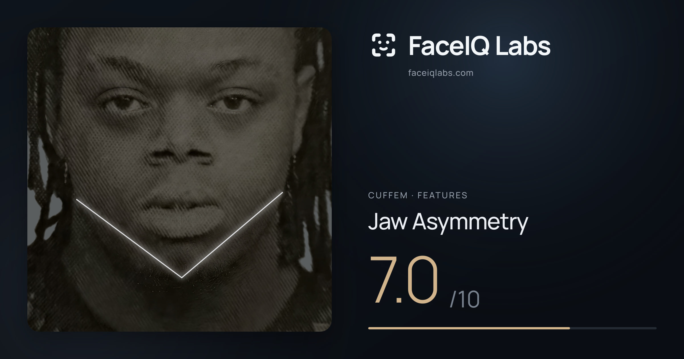 Cuffem Jaw Asymmetry: 7.0/10, drawn on the photo