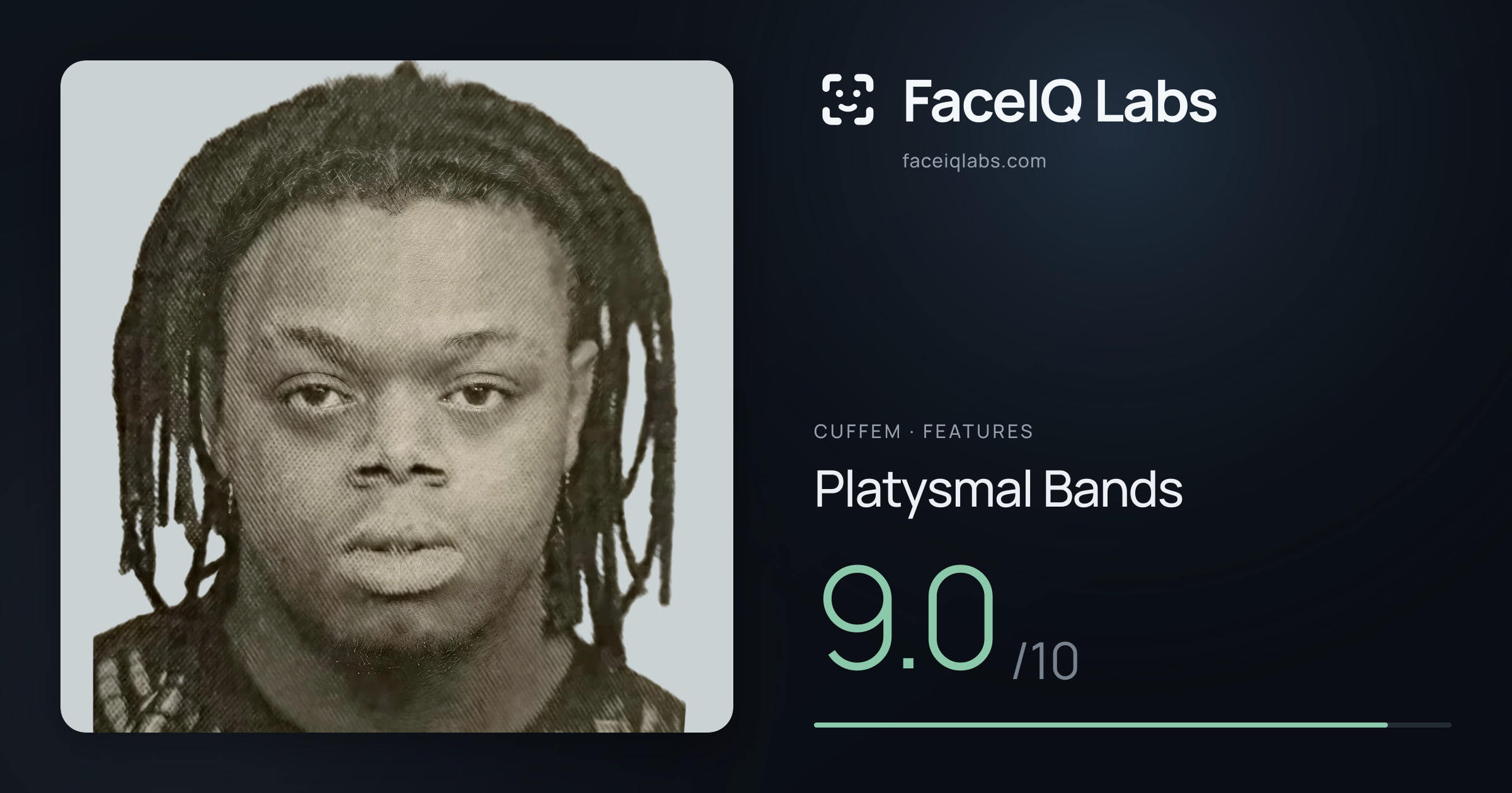 Cuffem Platysmal Bands: 9.0/10, drawn on the photo