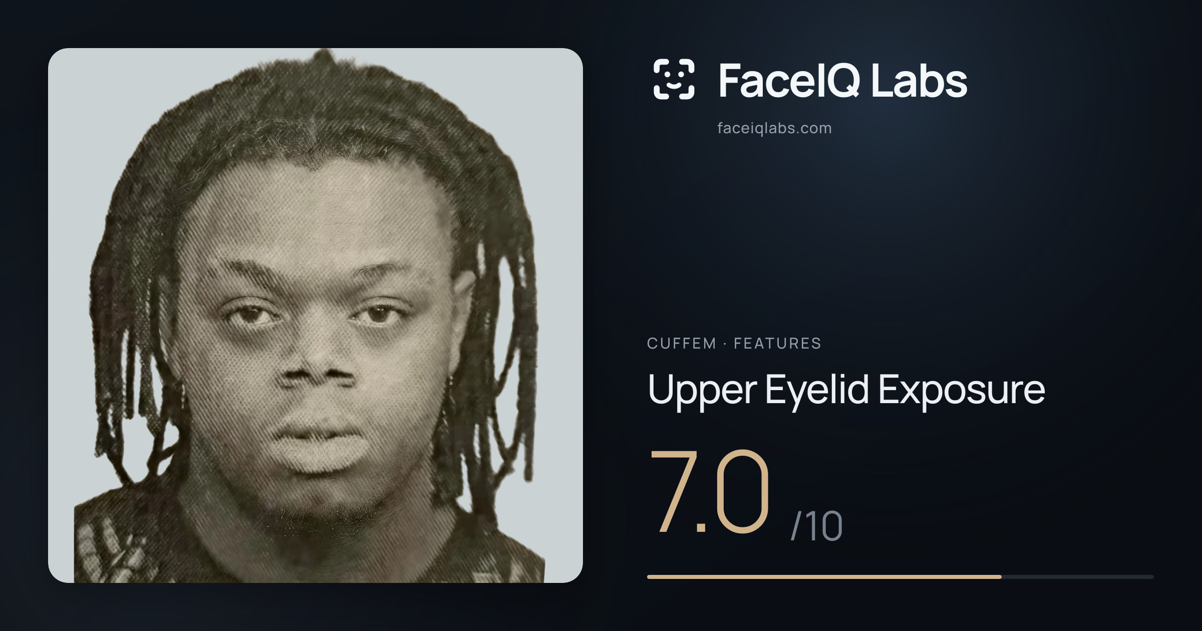 Cuffem Upper Eyelid Exposure: 7.0/10, drawn on the photo