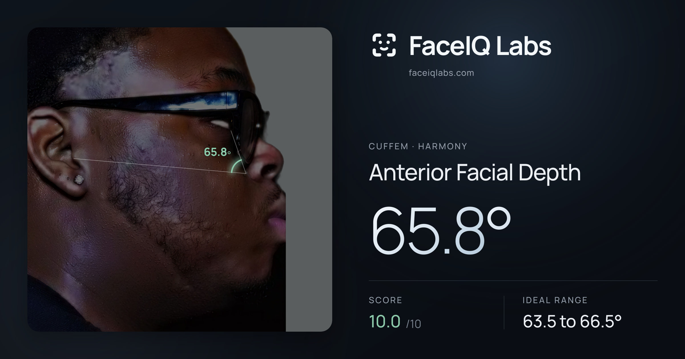 Cuffem Anterior Facial Depth: 65.8°, drawn on the photo