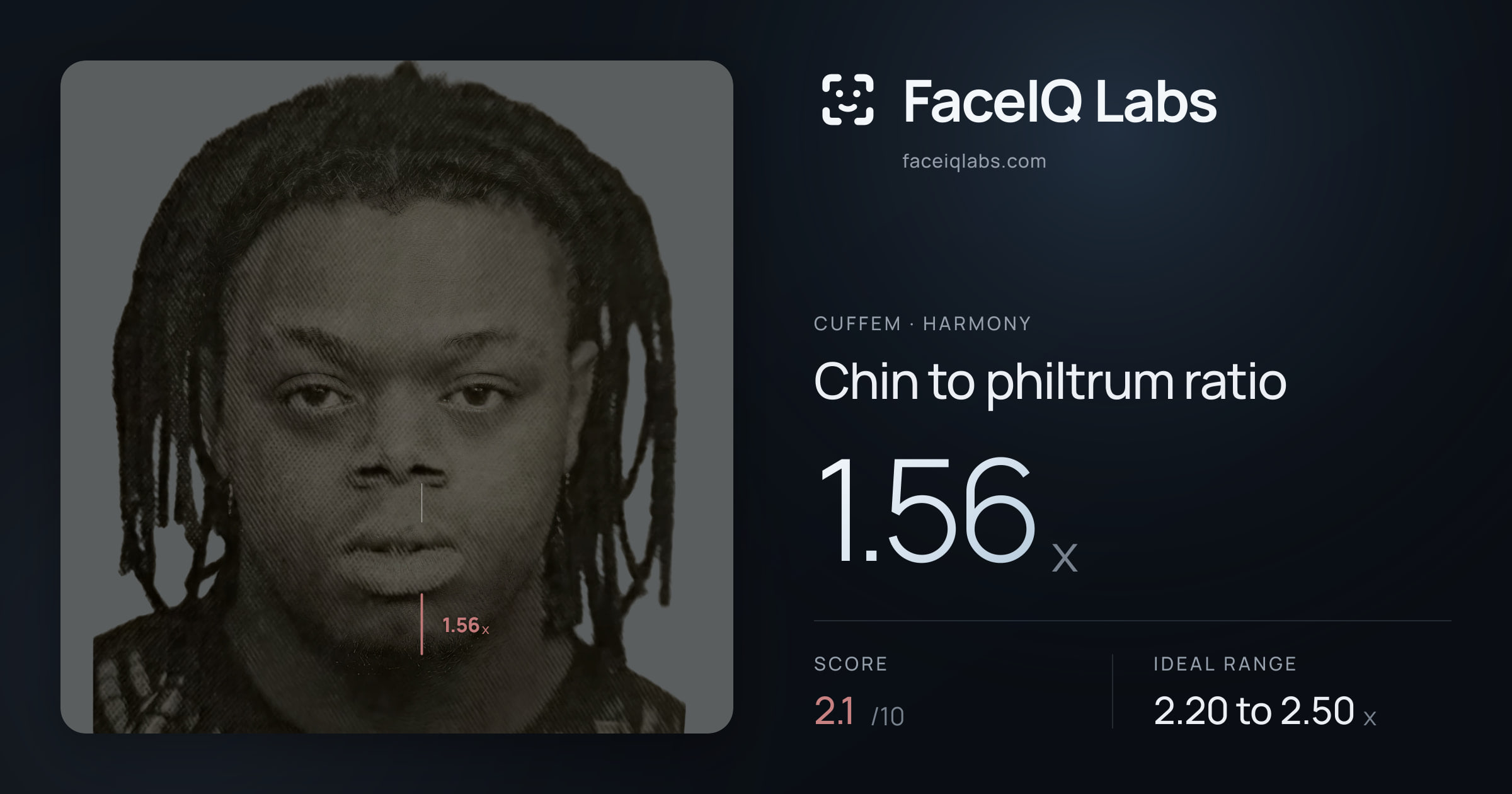 Cuffem Chin to philtrum ratio: 1.56x, drawn on the photo
