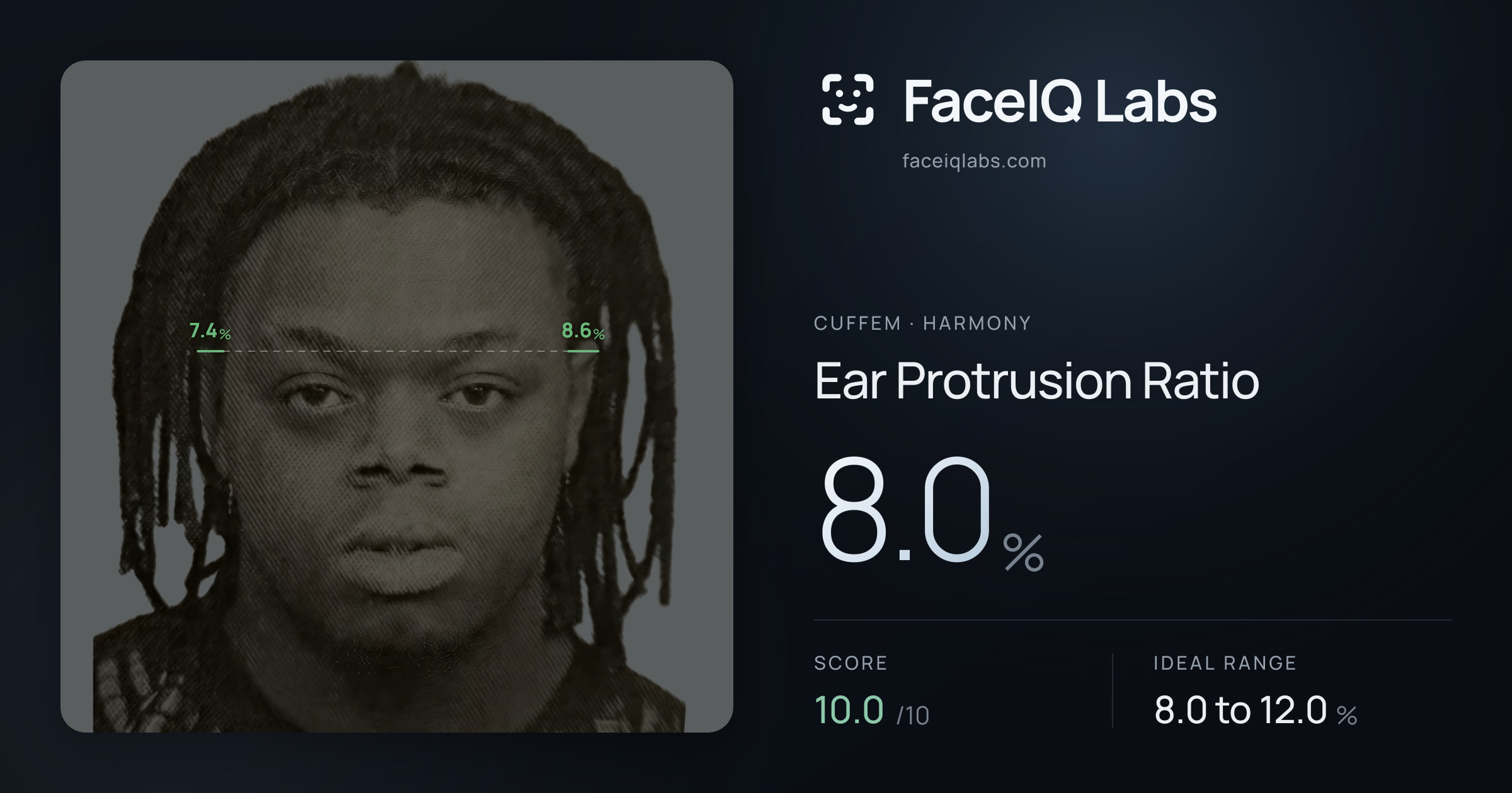 Cuffem Ear Protrusion Ratio: 8.0%, drawn on the photo