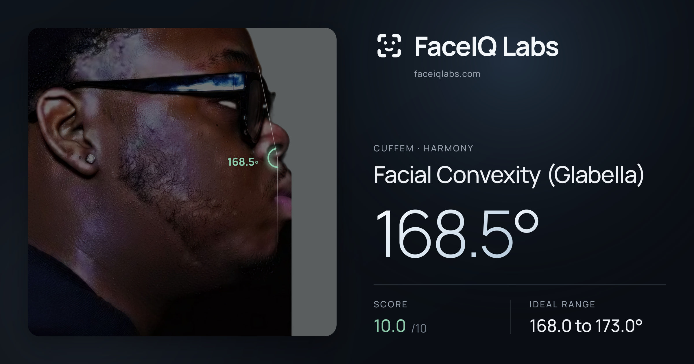 Cuffem Facial Convexity (Glabella): 168.5°, drawn on the photo