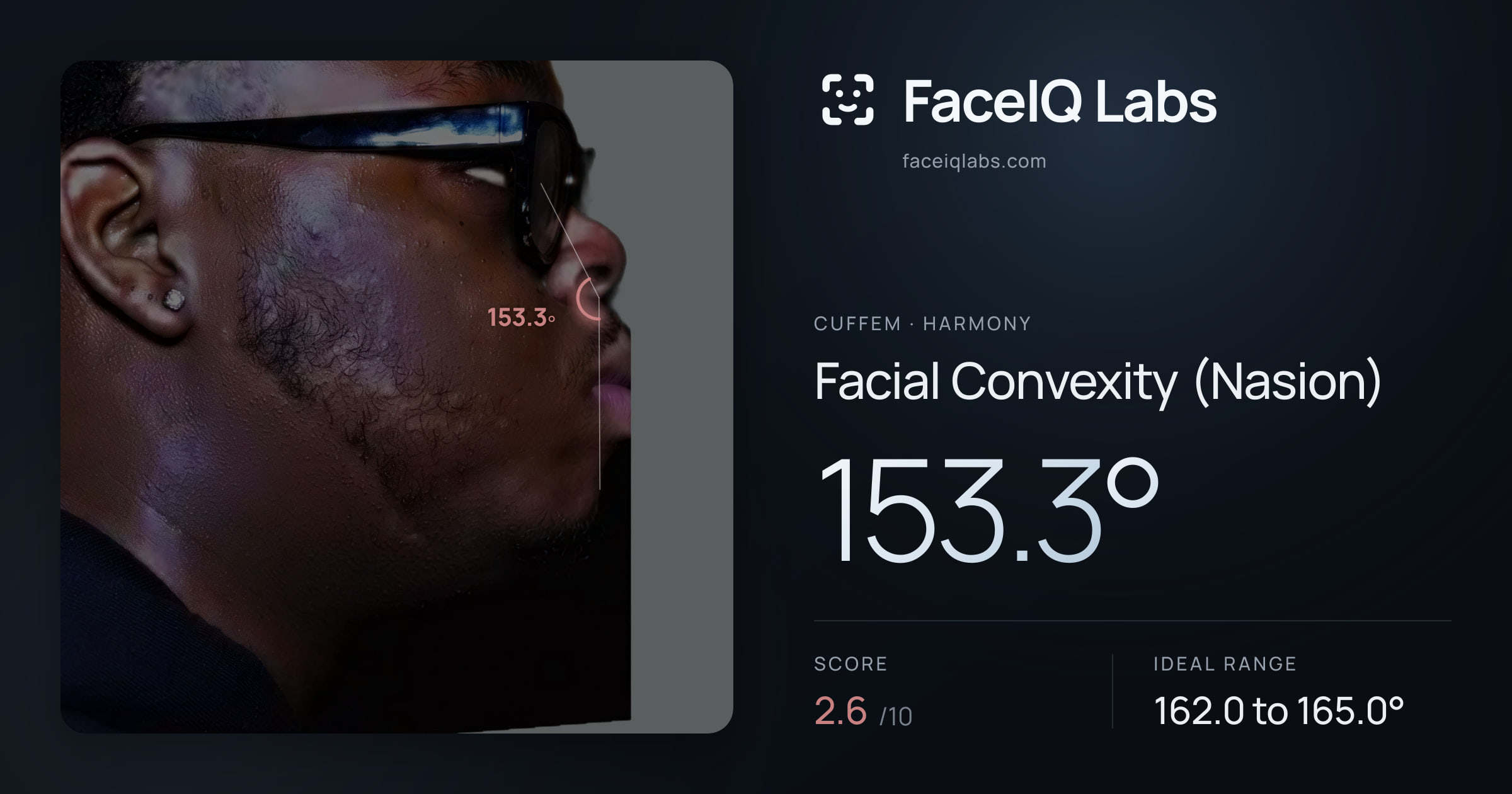 Cuffem Facial Convexity (Nasion): 153.3°, drawn on the photo