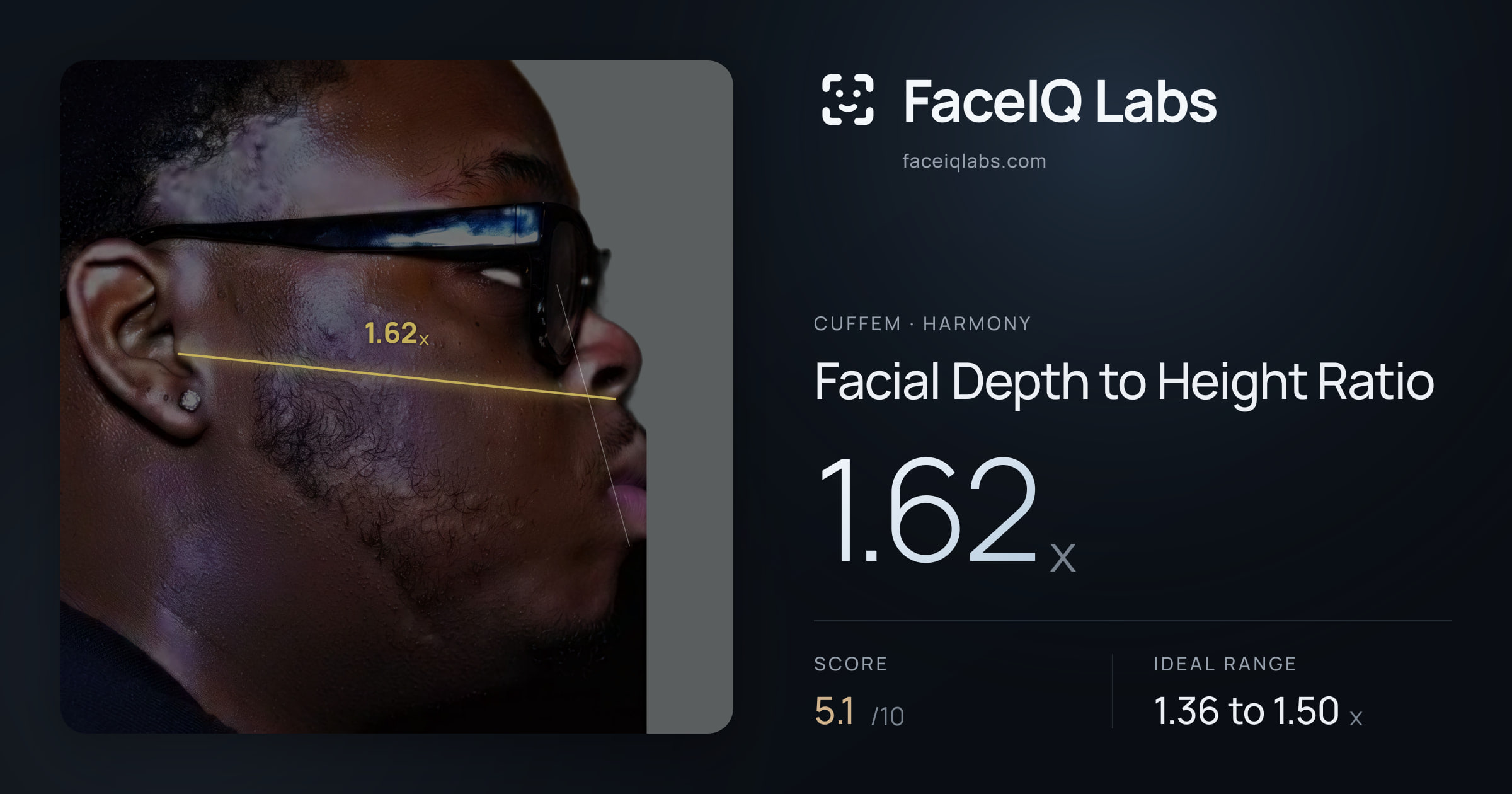 Cuffem Facial Depth to Height Ratio: 1.62x, drawn on the photo