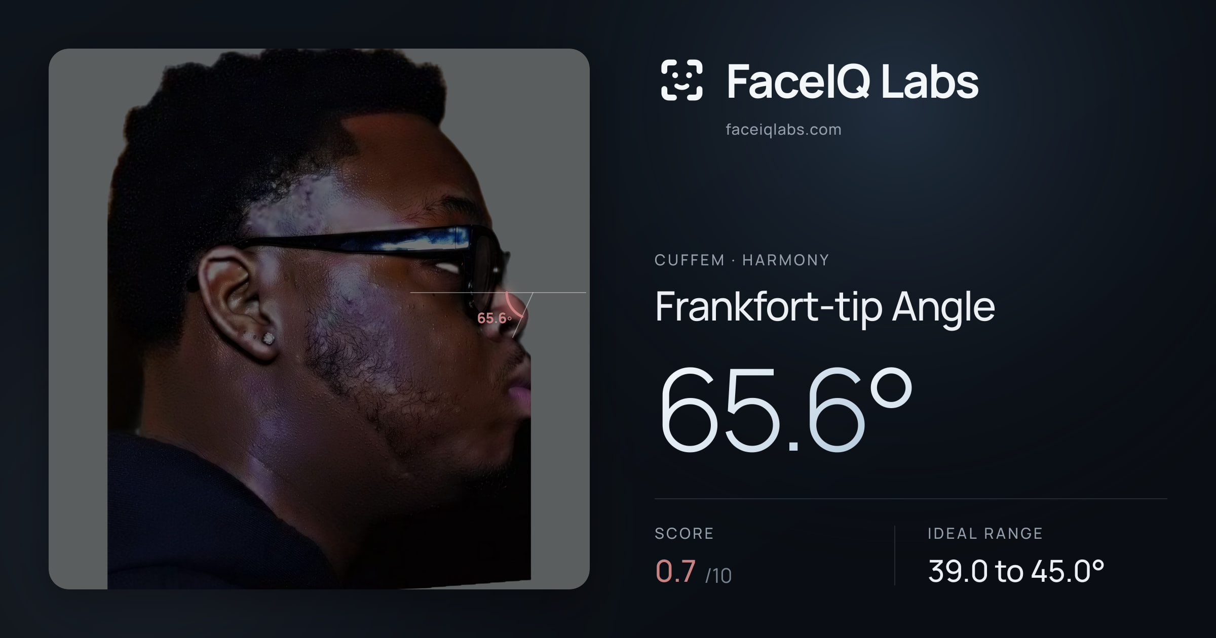 Cuffem Frankfort-tip Angle: 65.6°, drawn on the photo