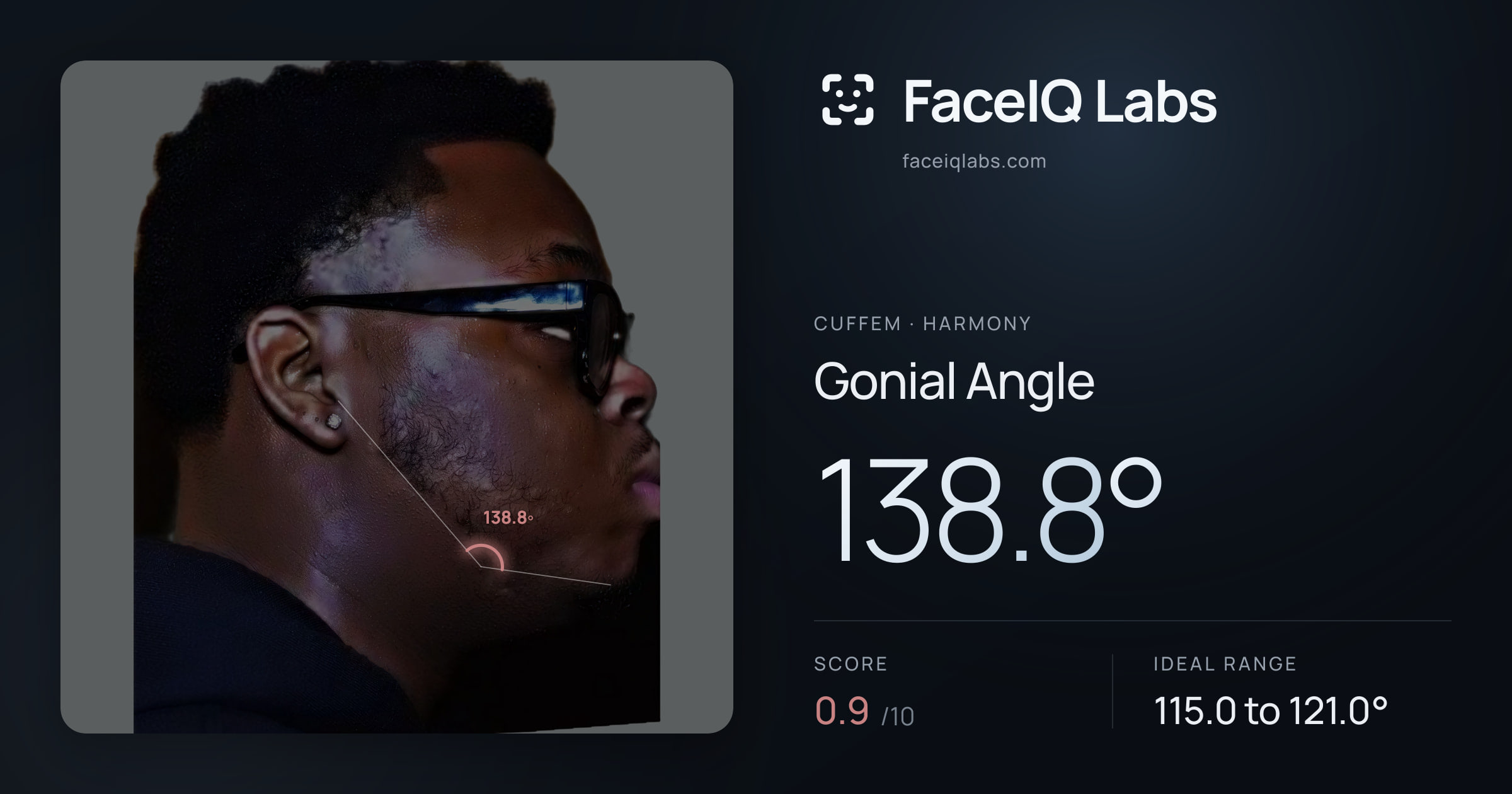 Cuffem Gonial Angle: 138.8°, drawn on the photo