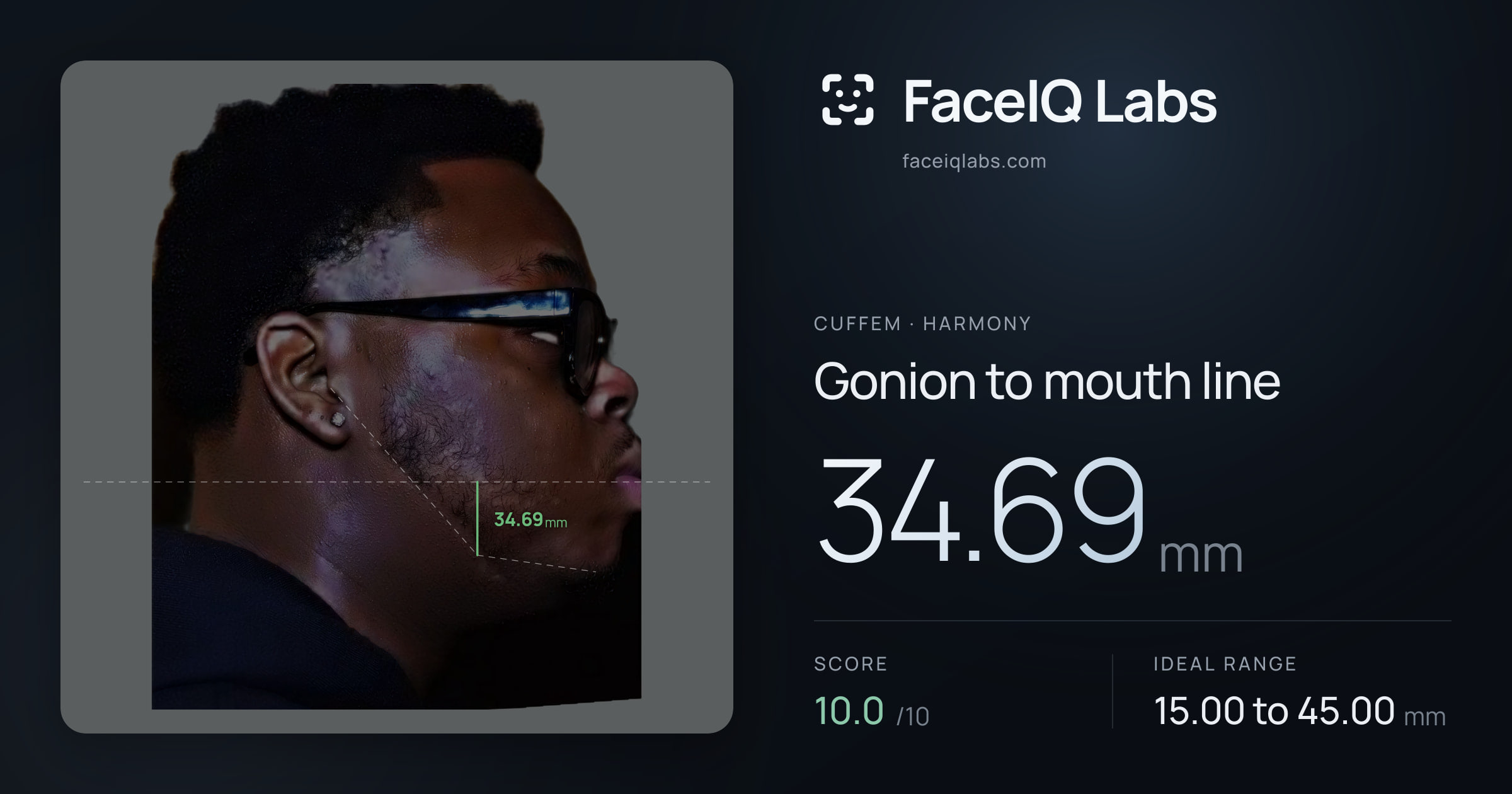 Cuffem Gonion to mouth line: 34.69mm, drawn on the photo