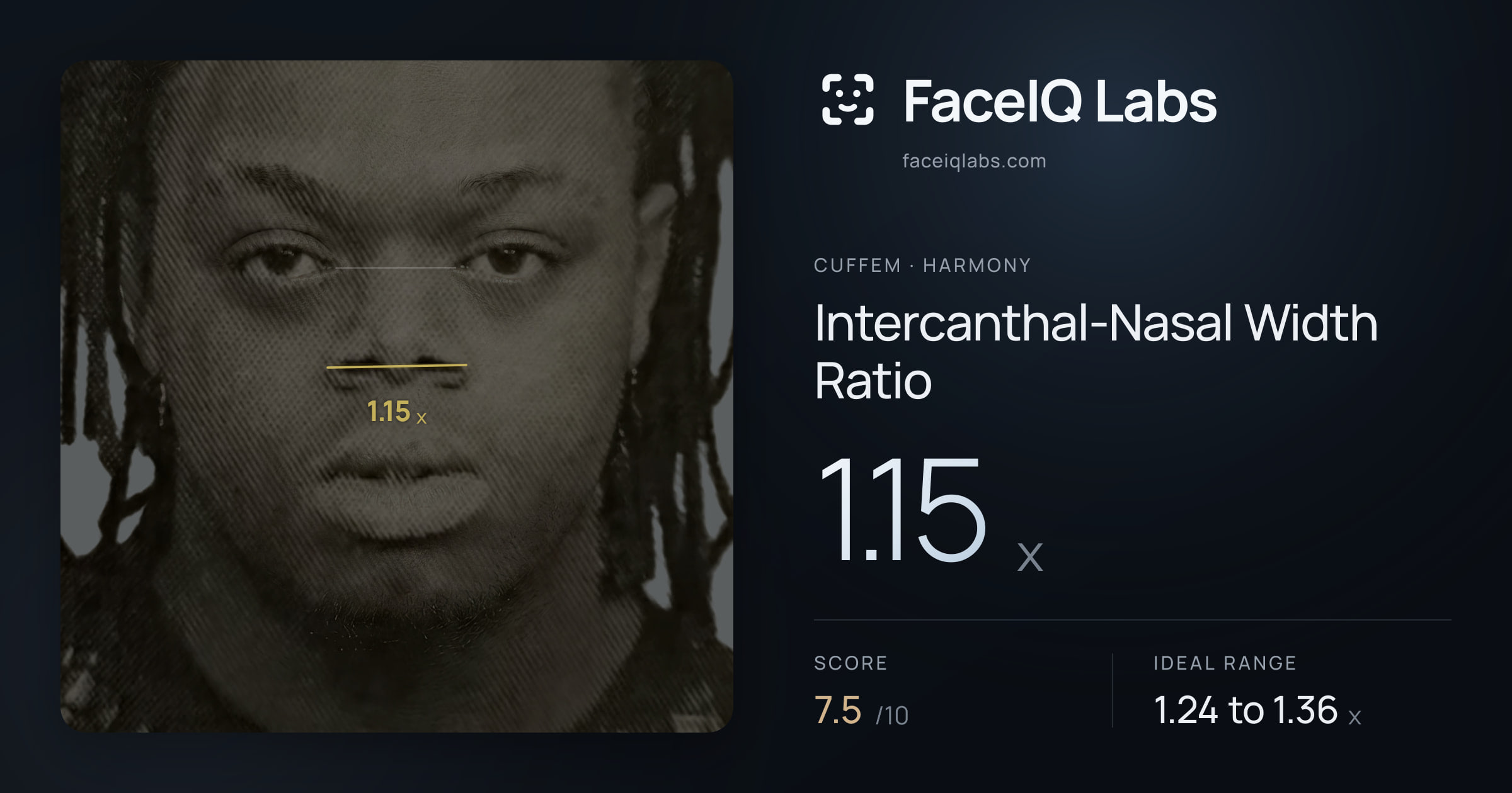 Cuffem Intercanthal-Nasal Width Ratio: 1.15x, drawn on the photo