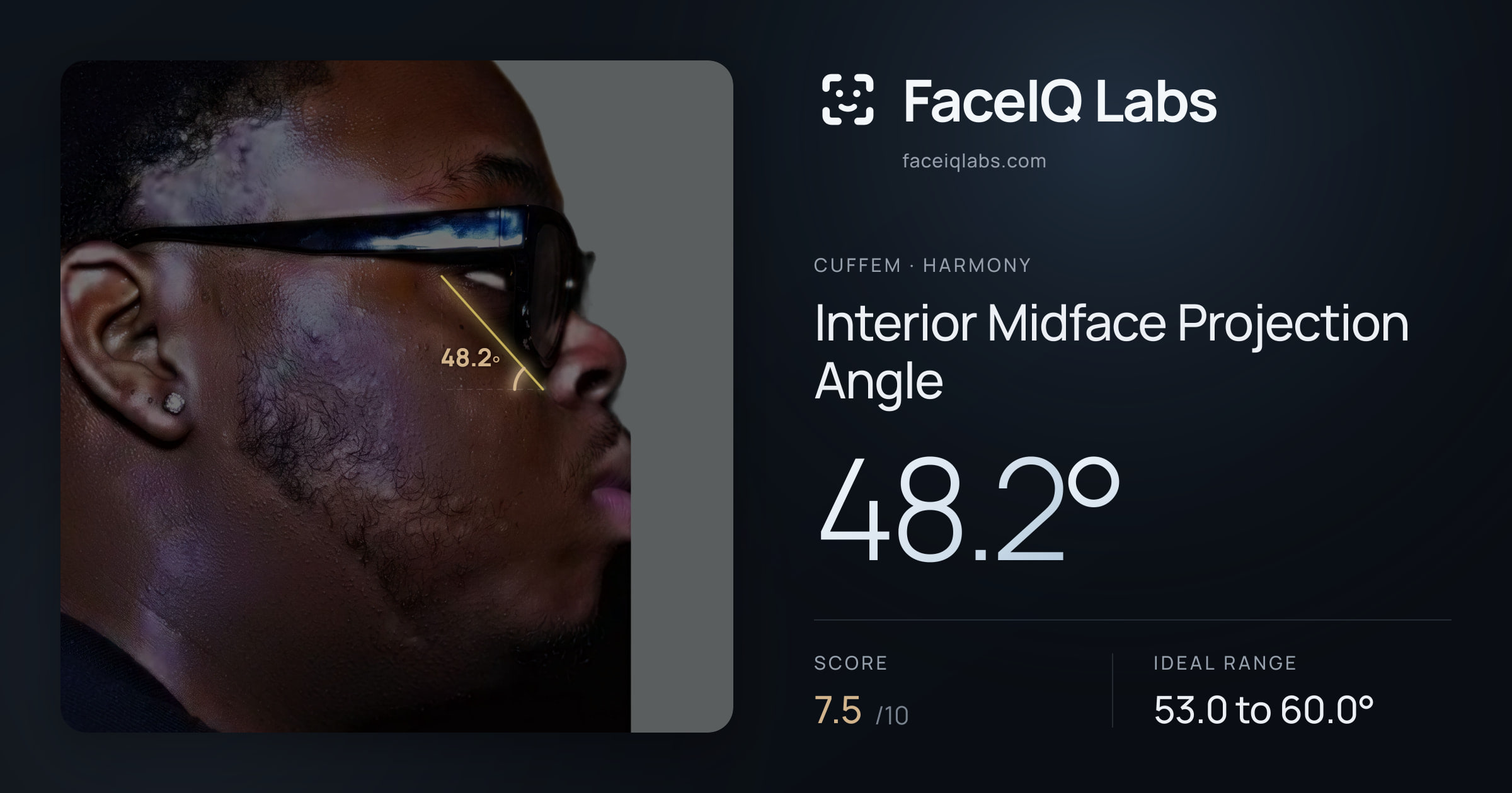 Cuffem Interior Midface Projection Angle: 48.2°, drawn on the photo