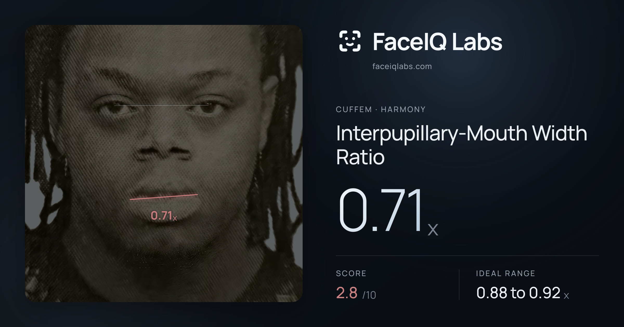 Cuffem Interpupillary-Mouth Width Ratio: 0.71x, drawn on the photo
