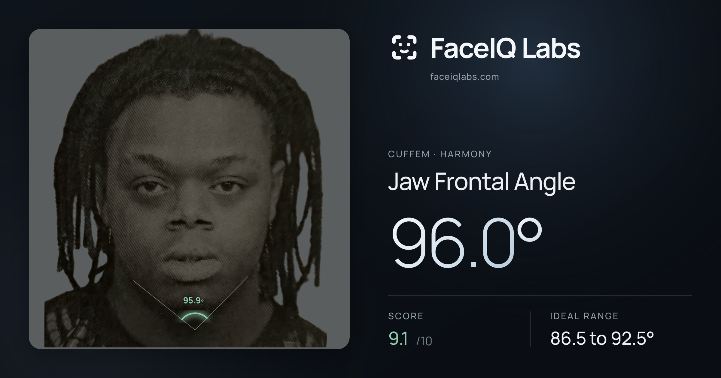 Cuffem Jaw Frontal Angle: 96.0°, drawn on the photo