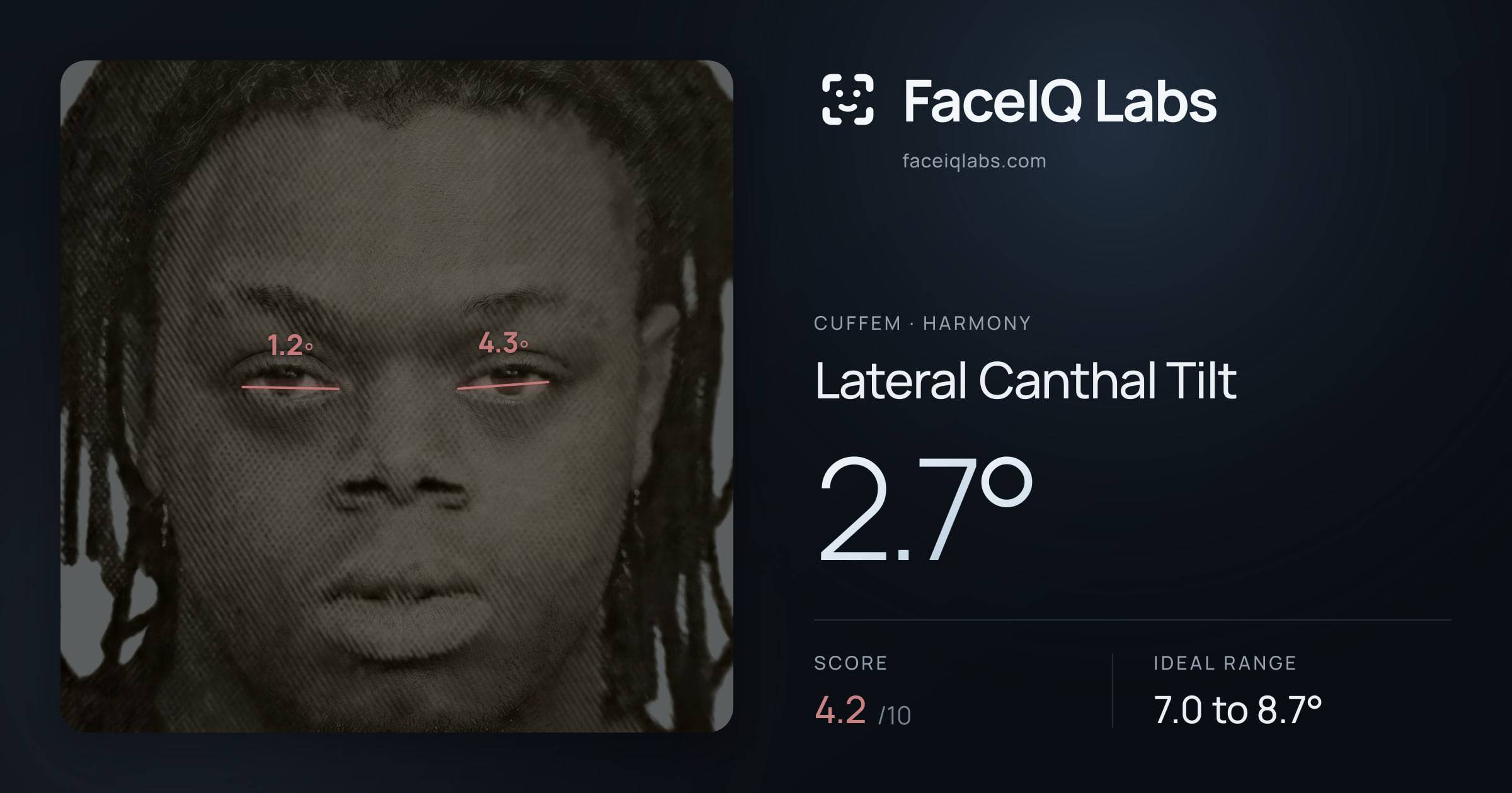 Cuffem Lateral Canthal Tilt: 2.7°, drawn on the photo