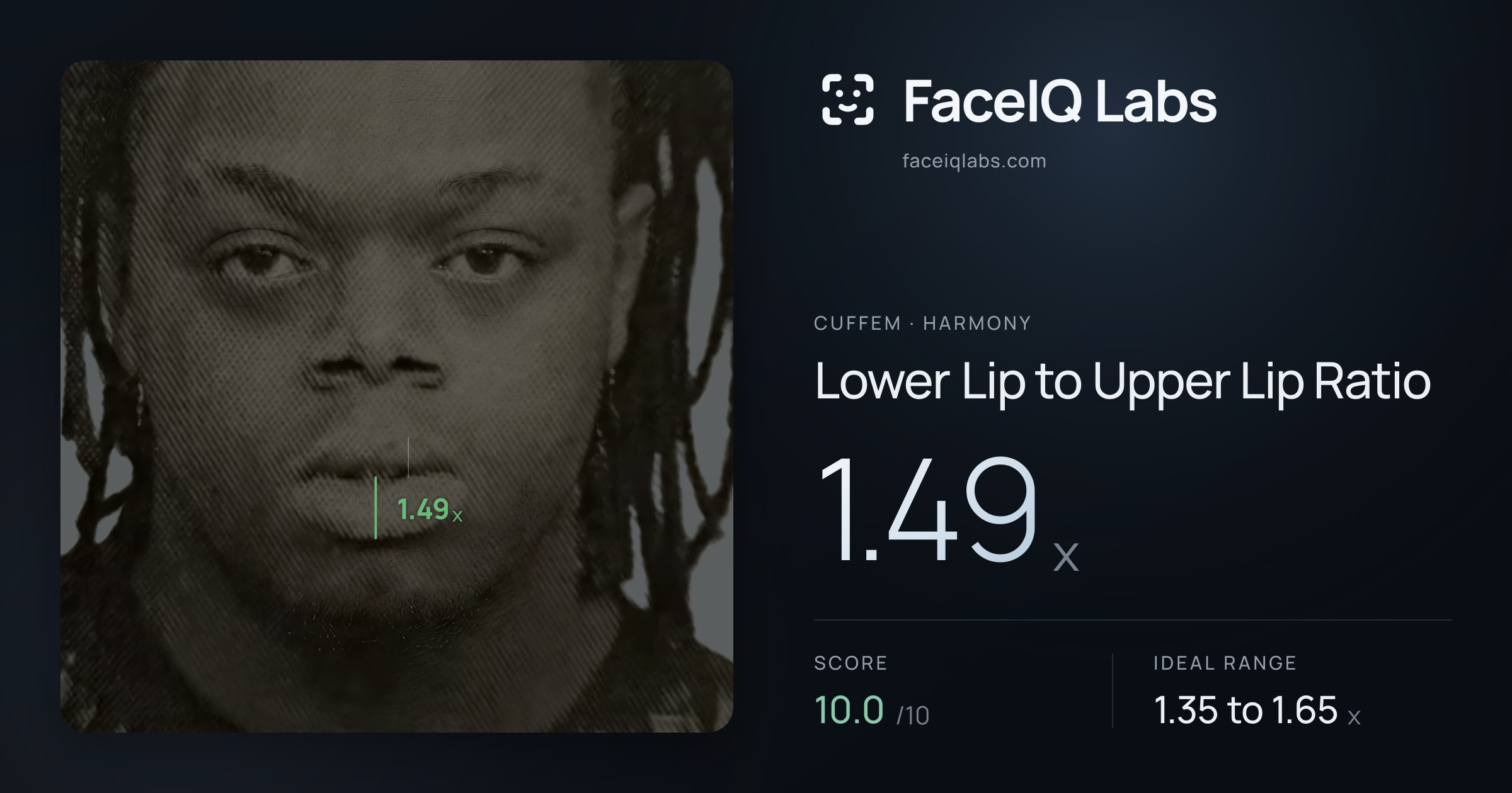 Cuffem Lower Lip to Upper Lip Ratio: 1.49x, drawn on the photo