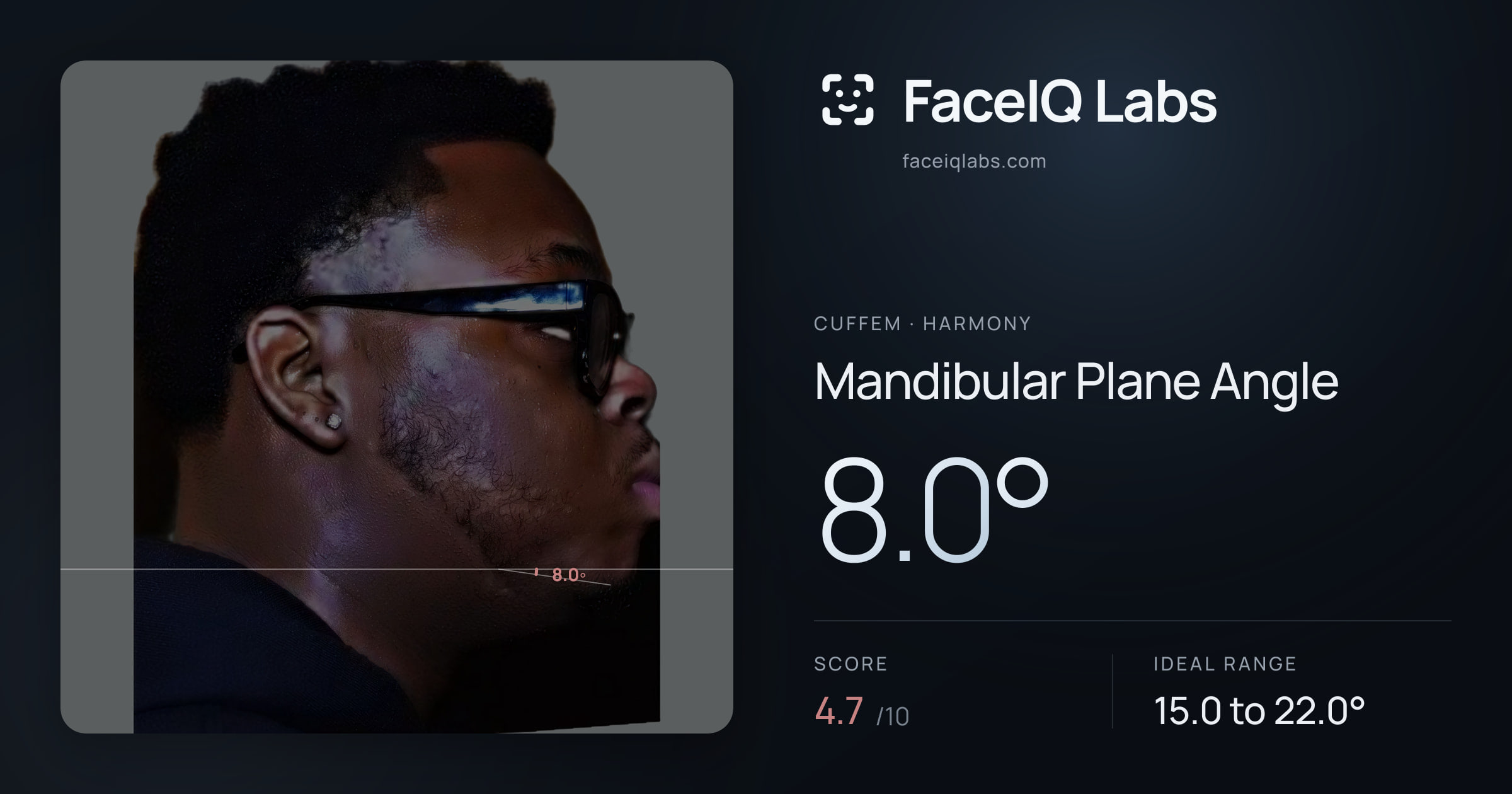 Cuffem Mandibular Plane Angle: 8.0°, drawn on the photo