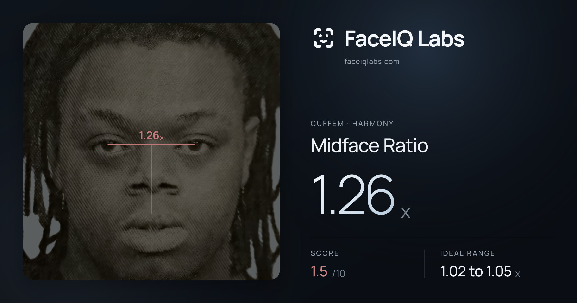 Cuffem Midface Ratio: 1.26x, drawn on the photo