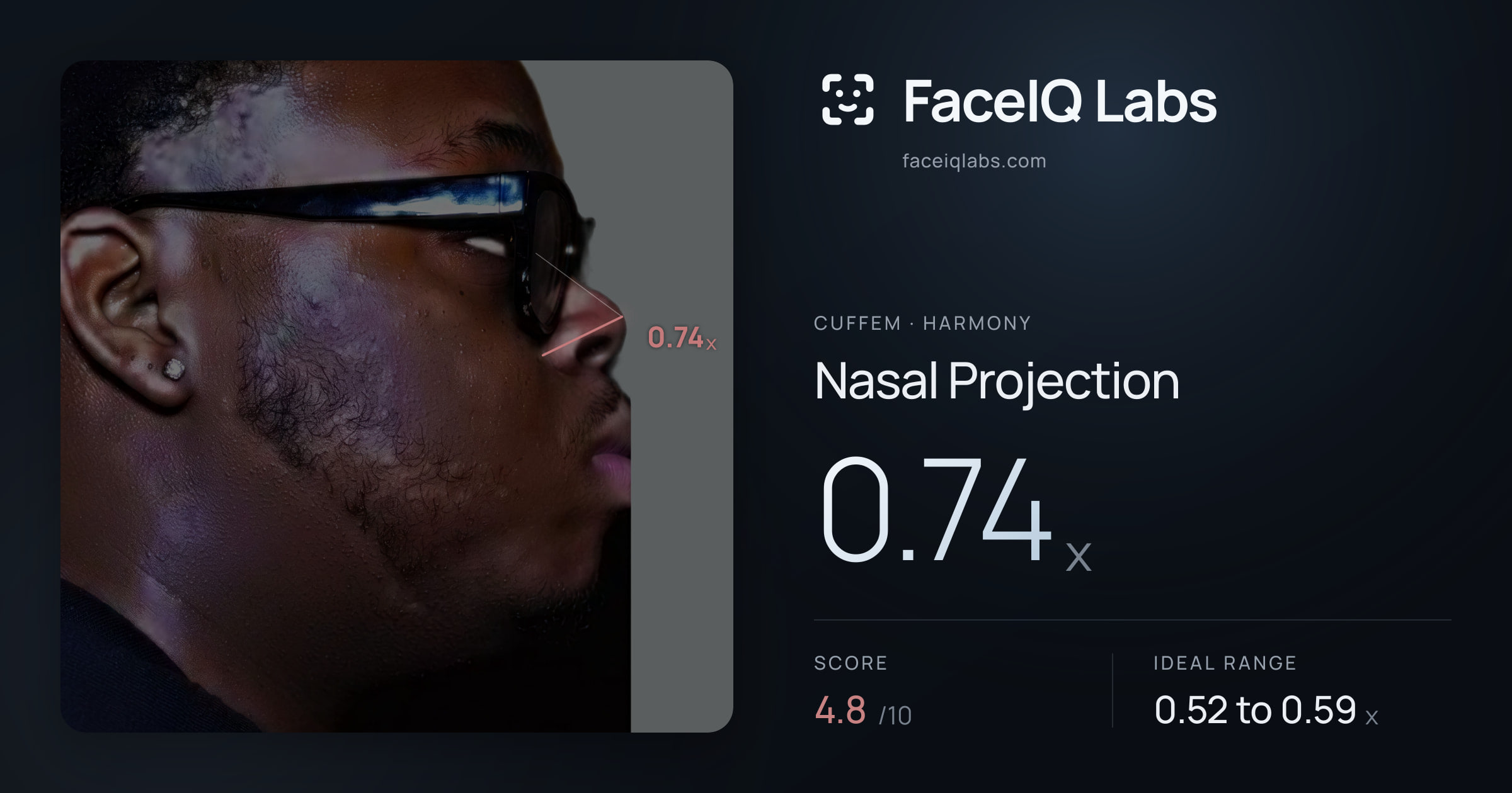 Cuffem Nasal Projection: 0.74x, drawn on the photo