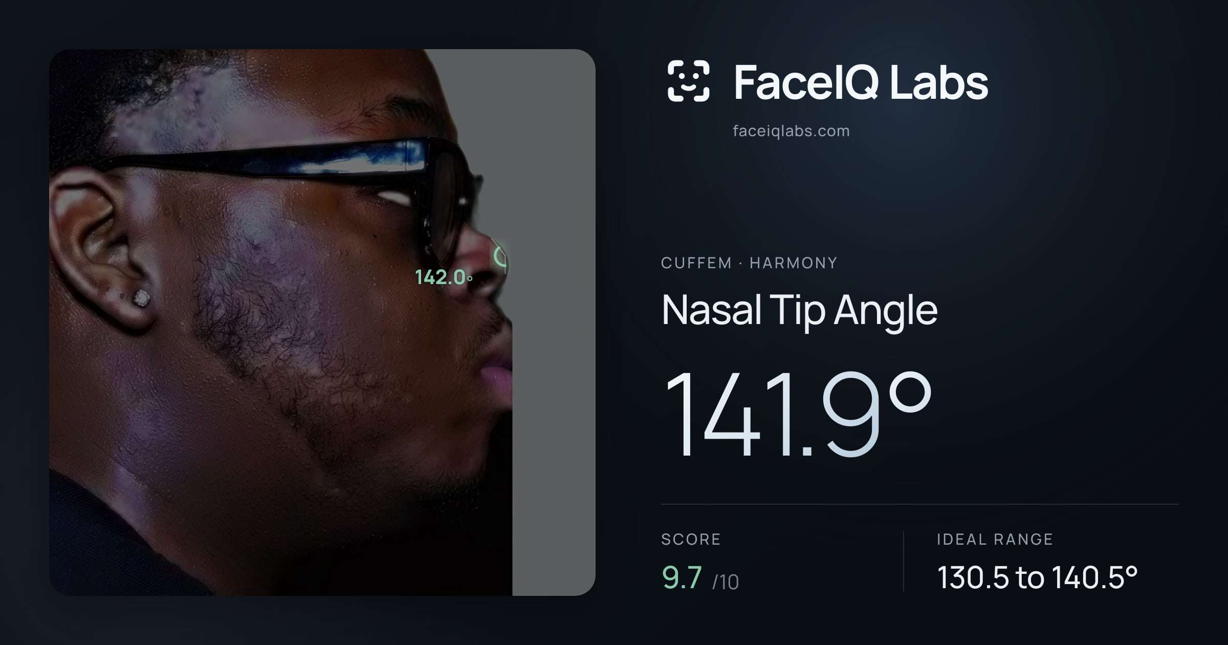 Cuffem Nasal Tip Angle: 141.9°, drawn on the photo