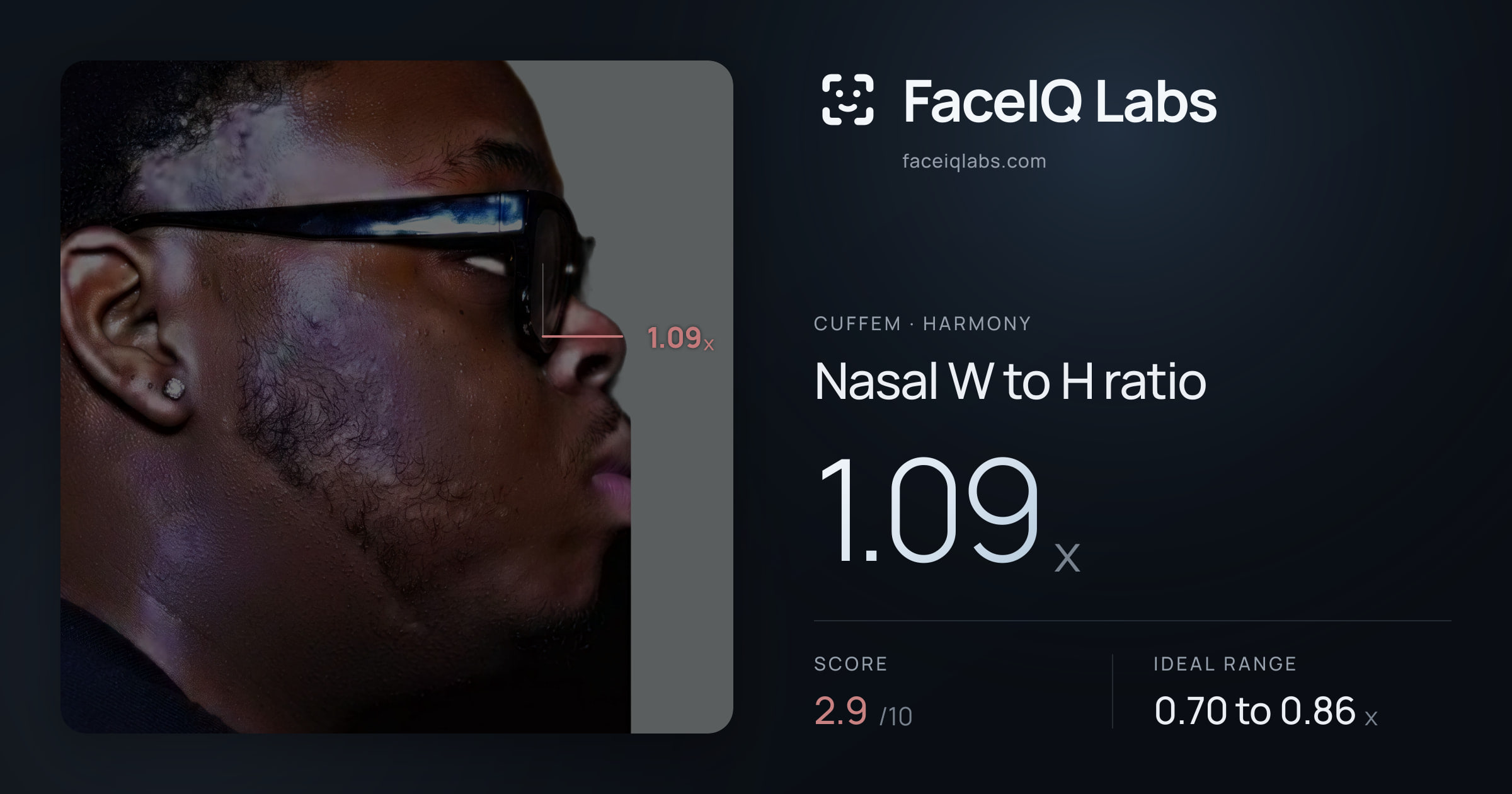 Cuffem Nasal W to H ratio: 1.09x, drawn on the photo