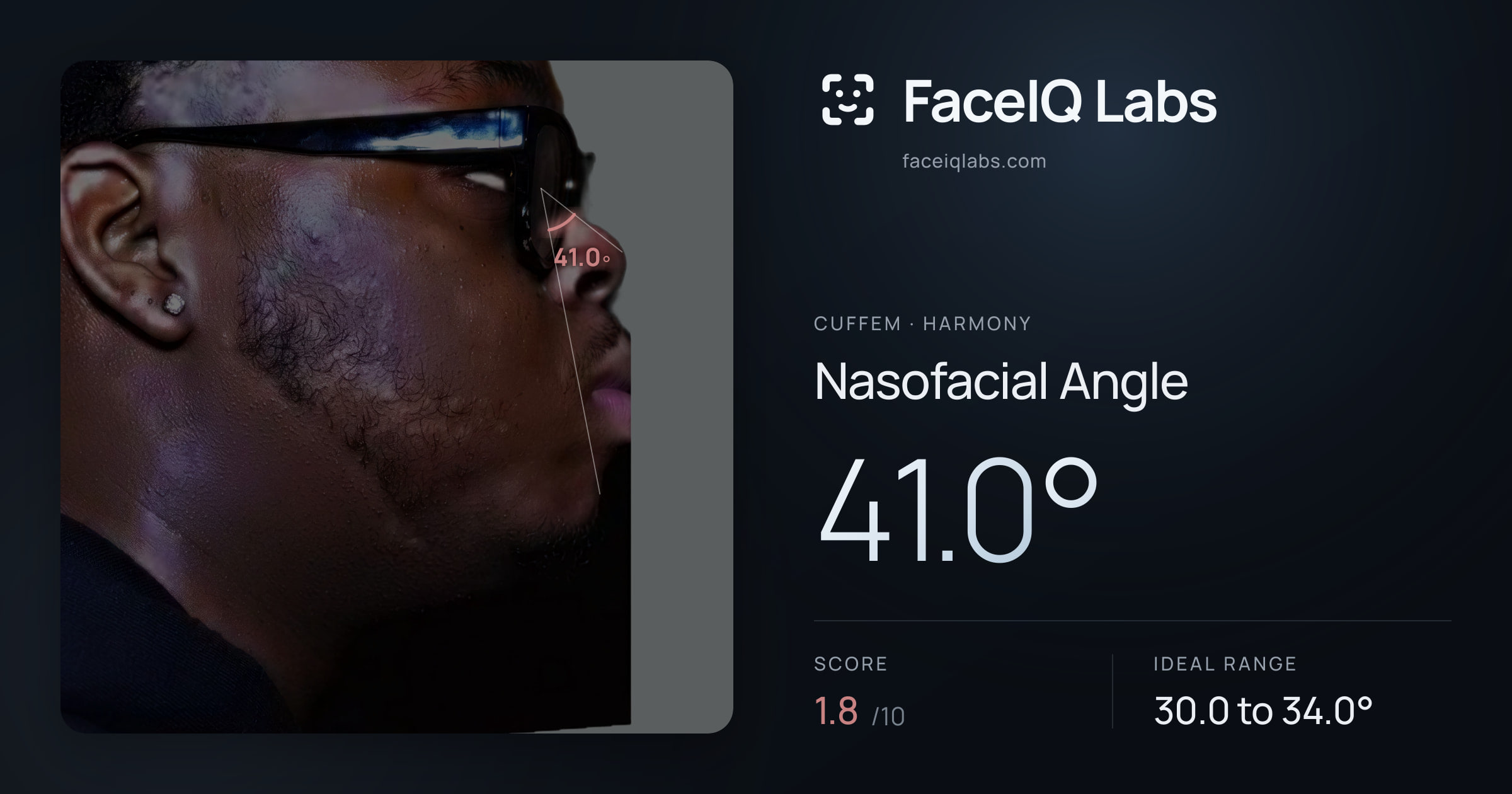 Cuffem Nasofacial Angle: 41.0°, drawn on the photo