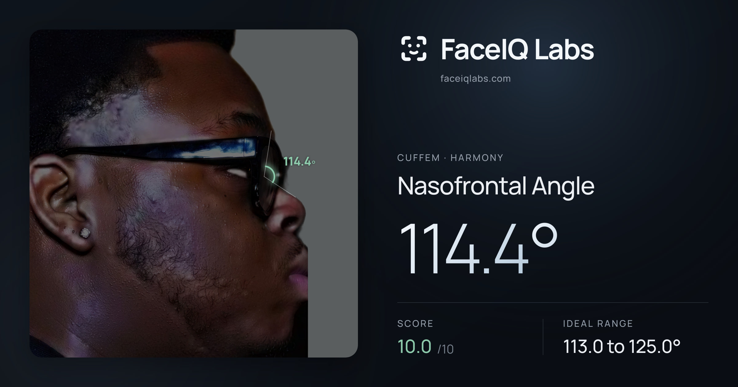 Cuffem Nasofrontal Angle: 114.4°, drawn on the photo