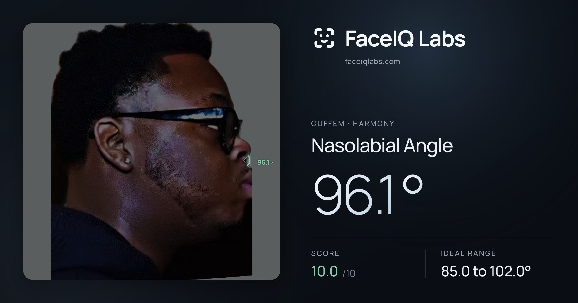 Cuffem Nasolabial Angle: 96.1°, drawn on the photo