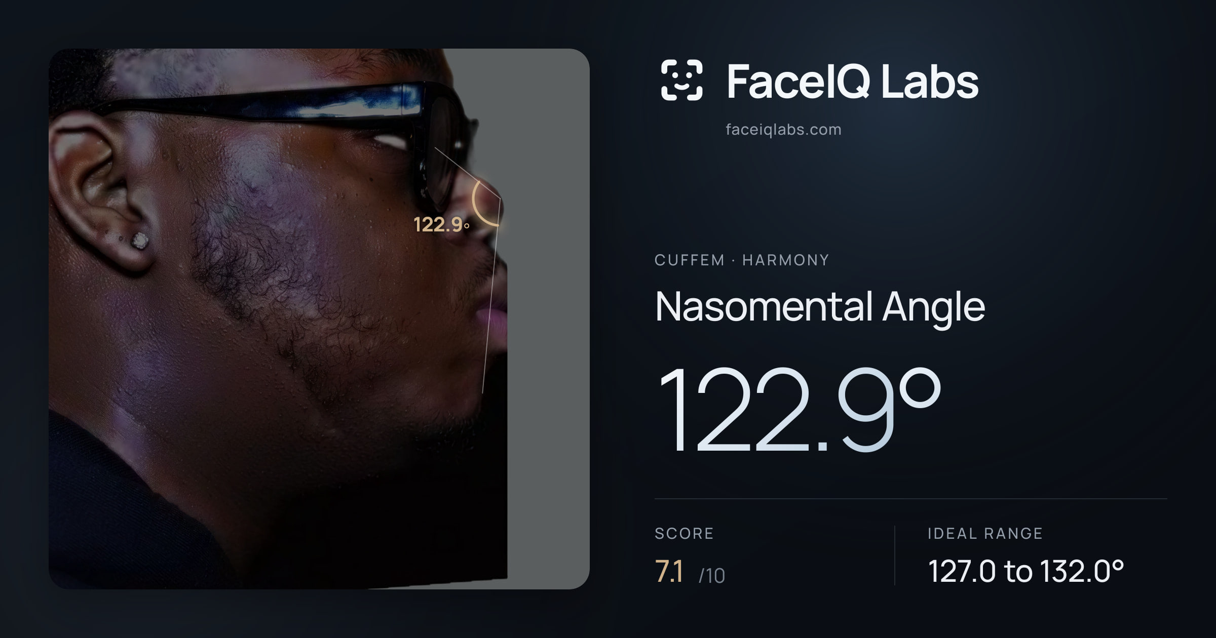 Cuffem Nasomental Angle: 122.9°, drawn on the photo