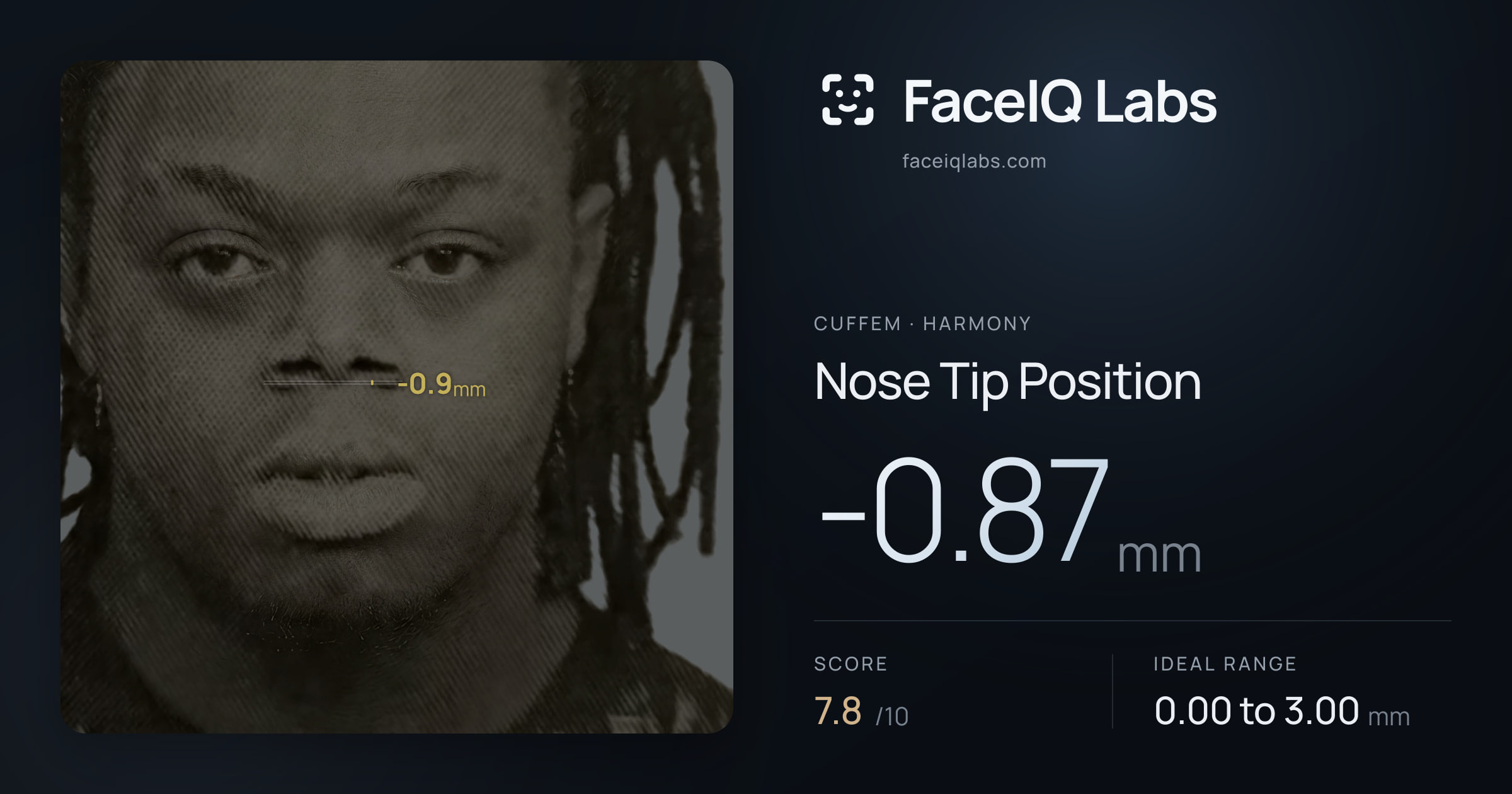 Cuffem Nose Tip Position: -0.87mm, drawn on the photo