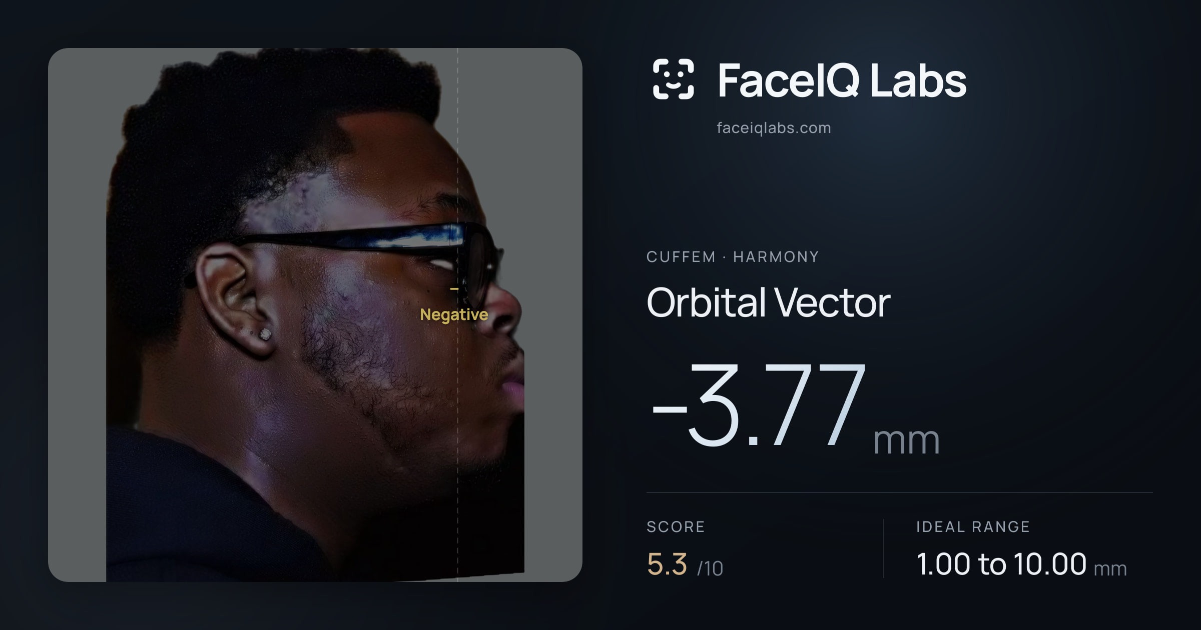 Cuffem Orbital Vector: -3.77mm, drawn on the photo
