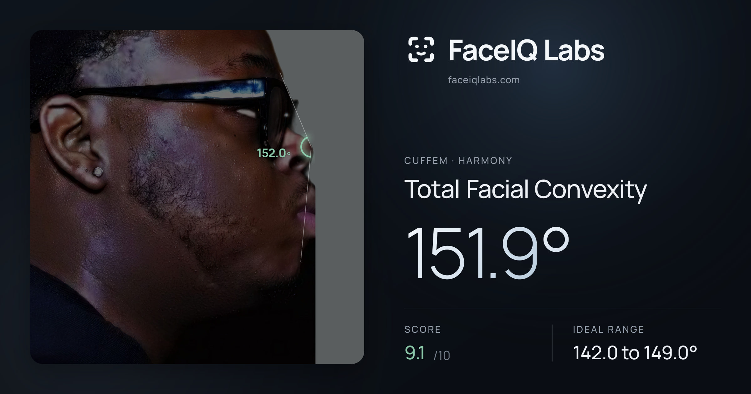 Cuffem Total Facial Convexity: 151.9°, drawn on the photo
