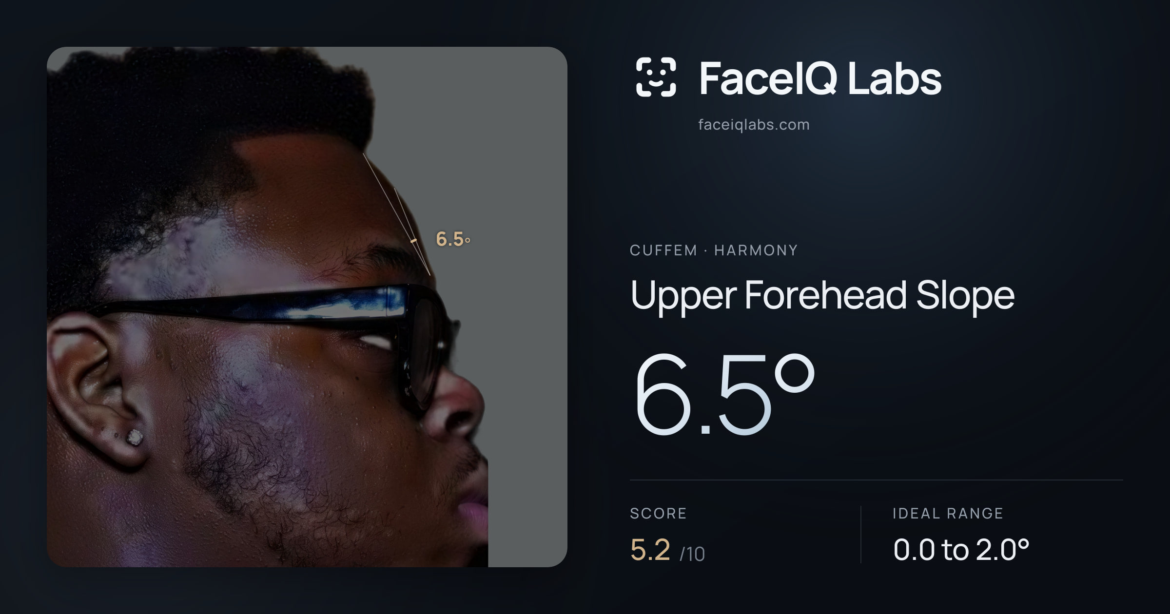 Cuffem Upper Forehead Slope: 6.5°, drawn on the photo