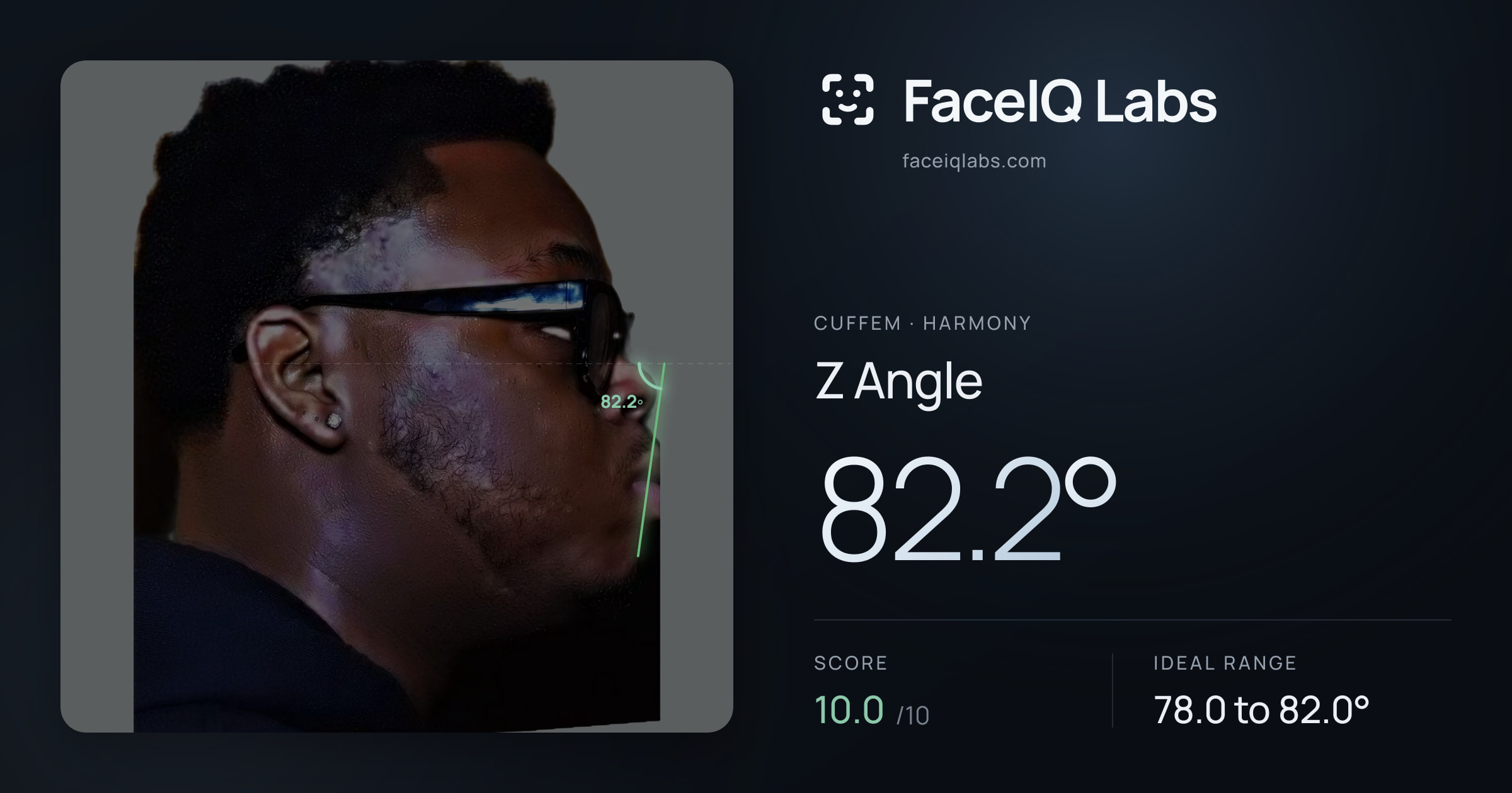 Cuffem Z Angle: 82.2°, drawn on the photo