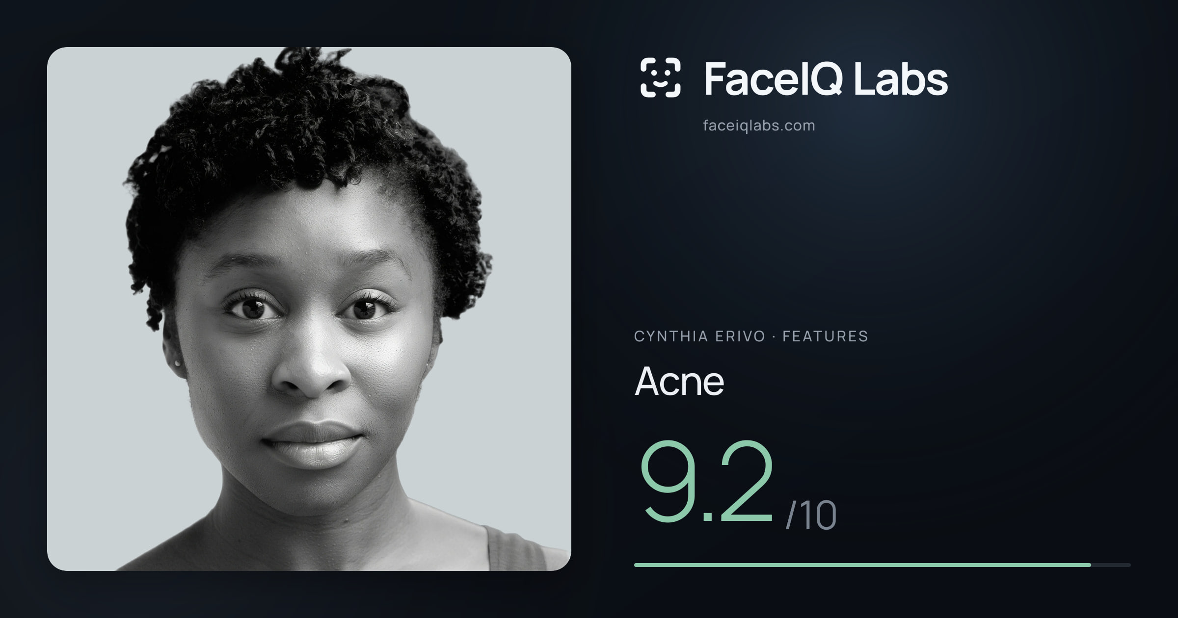Cynthia Erivo Acne: 9.2/10, drawn on the photo