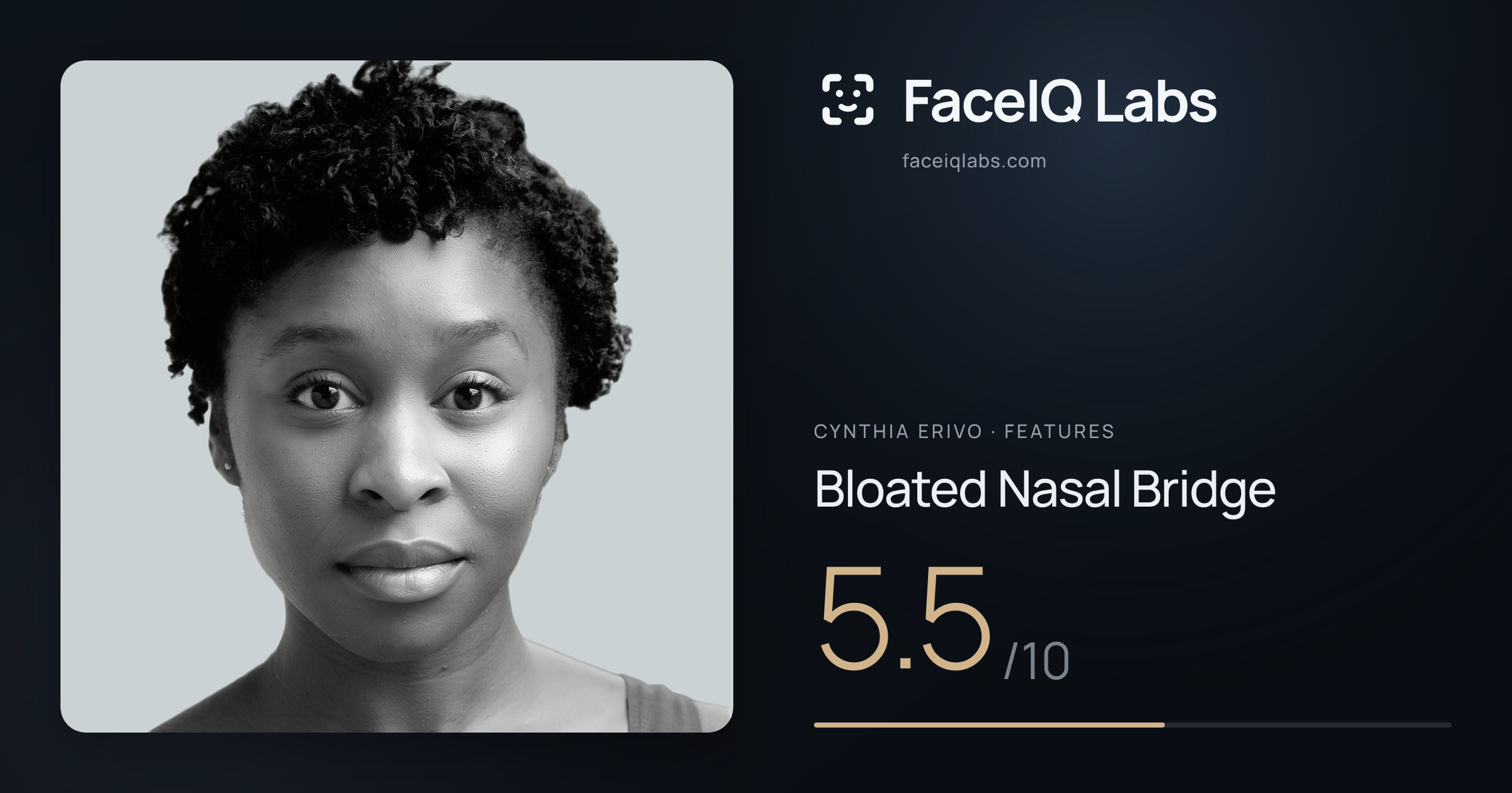 Cynthia Erivo Bloated Nasal Bridge: 5.5/10, drawn on the photo